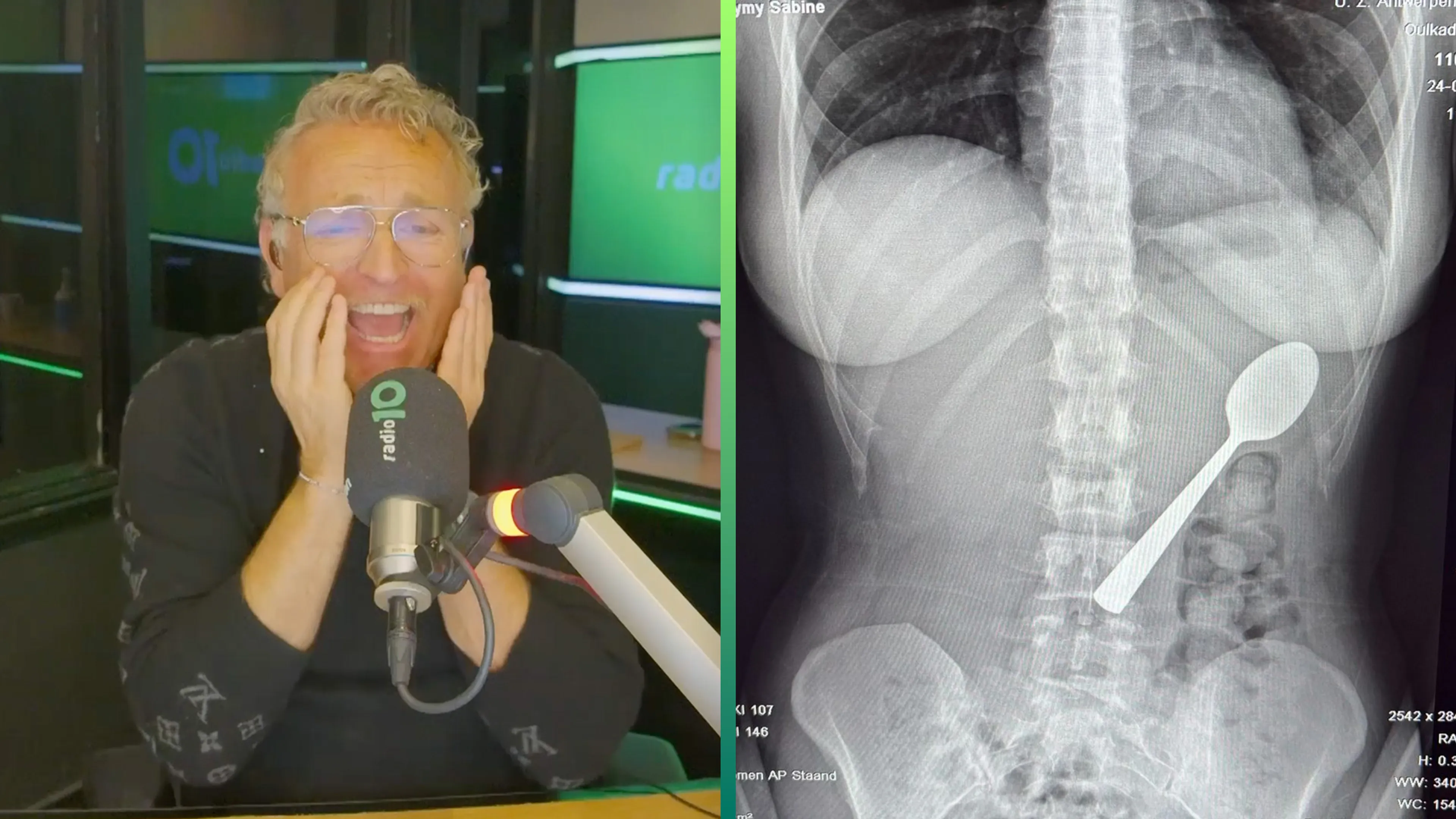 Reymy slikte een lepel van 17 (!) centimeter in: 'Heeft er anderhalve dag ingezeten'