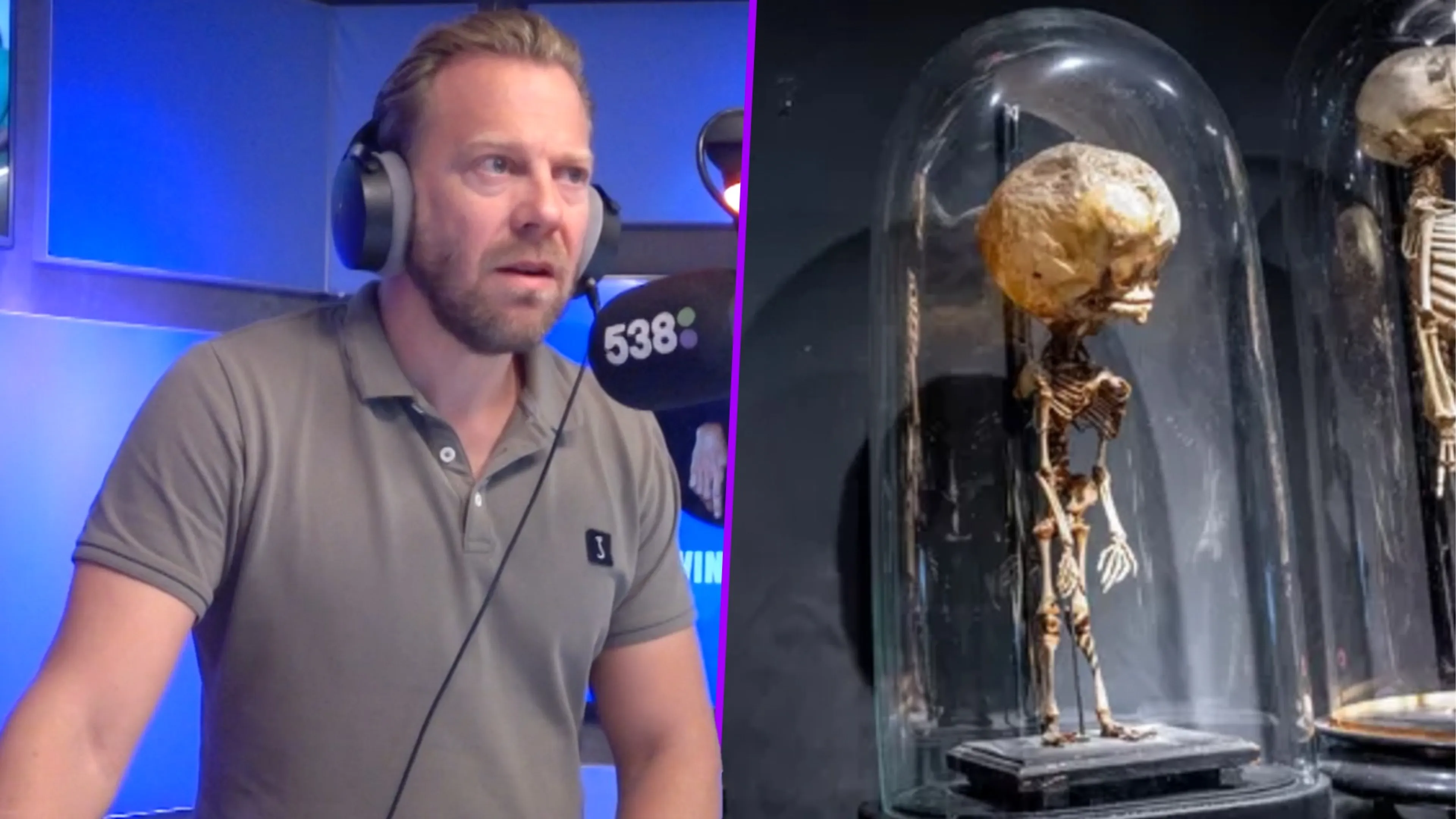 Erwin verkoopt het skelet van een waterhoofdbaby