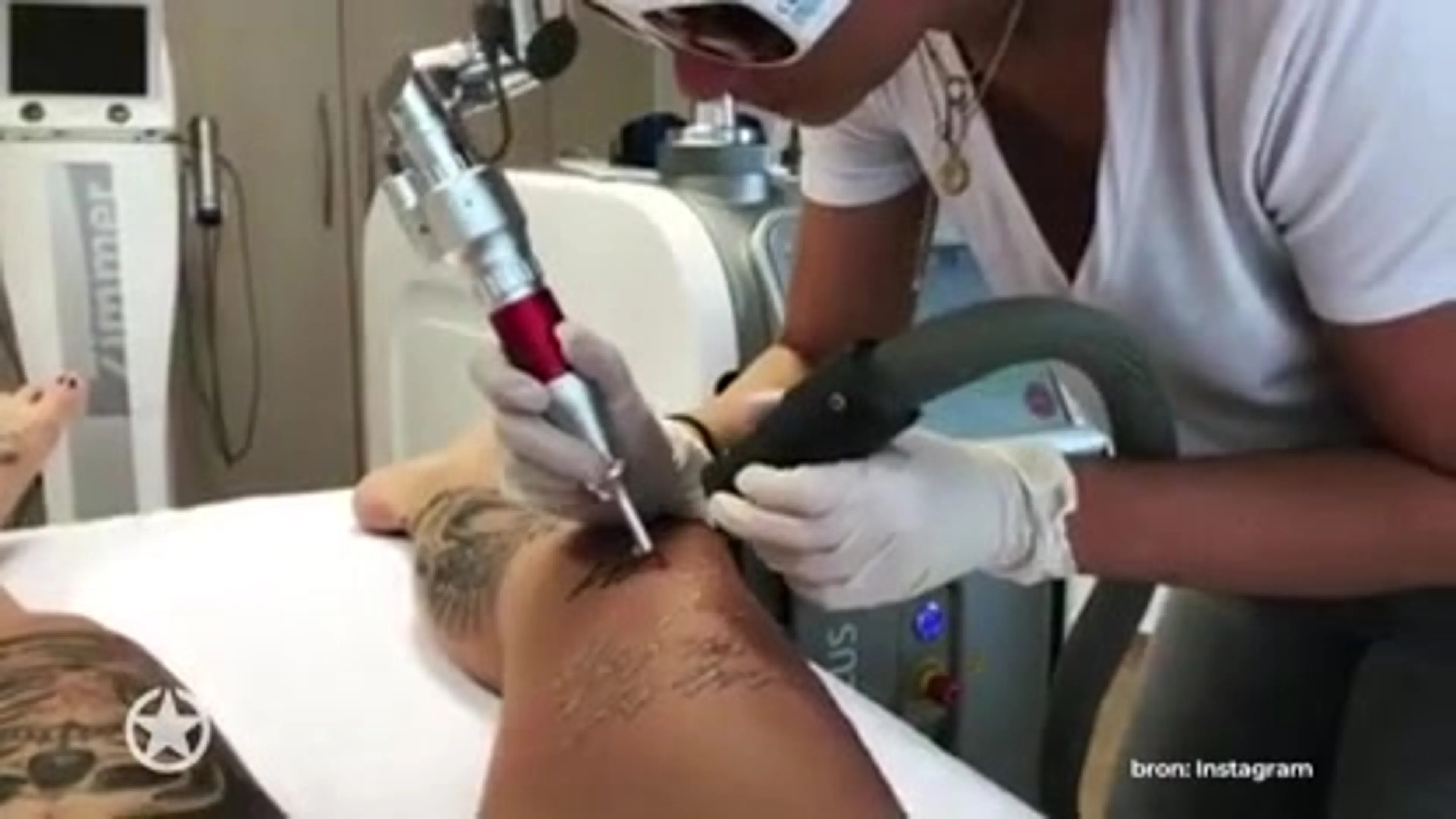 Pommeline verwijdert de naamtattoo van Fabrizio