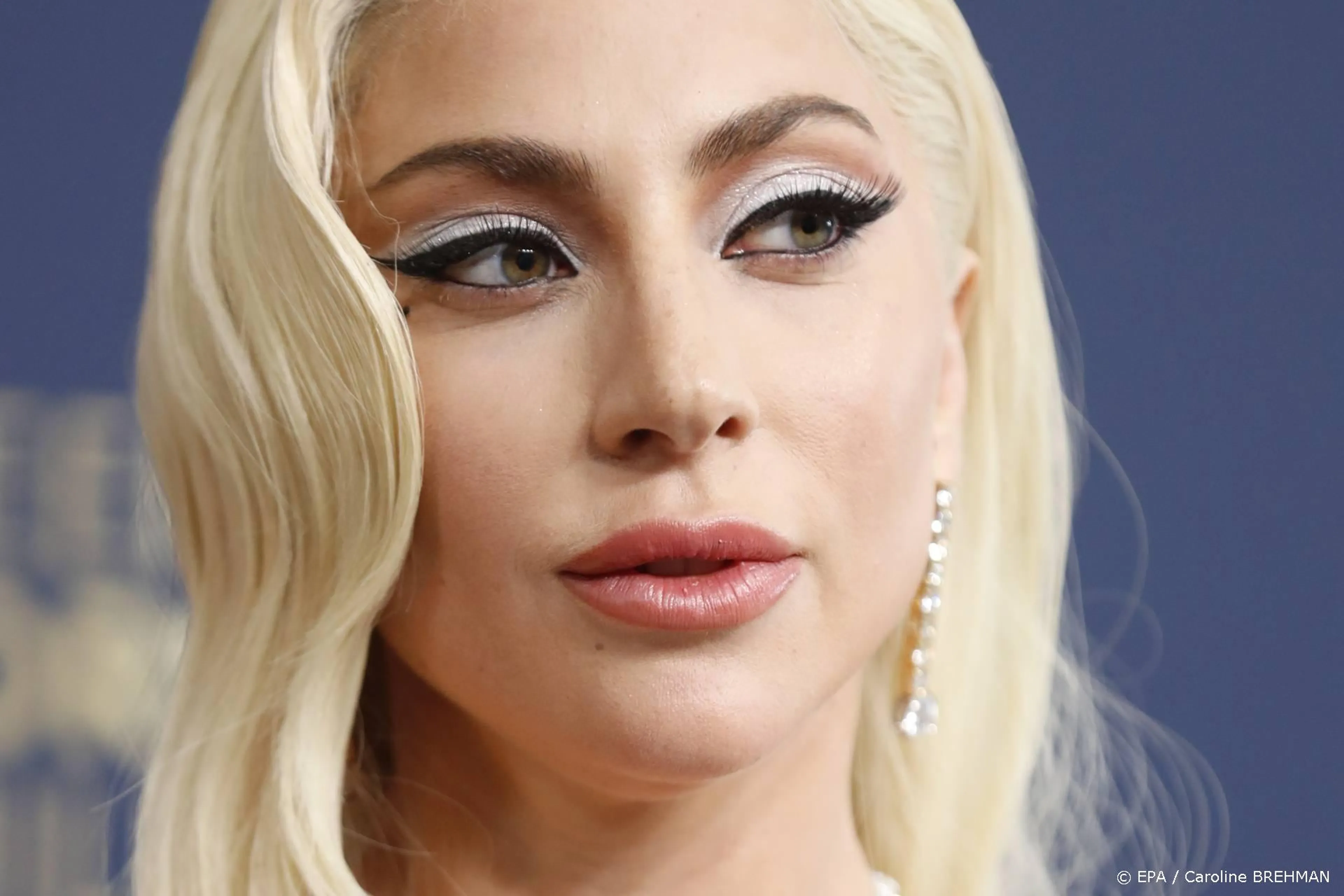 Vier jaar cel voor man die honden van Lady Gaga stal