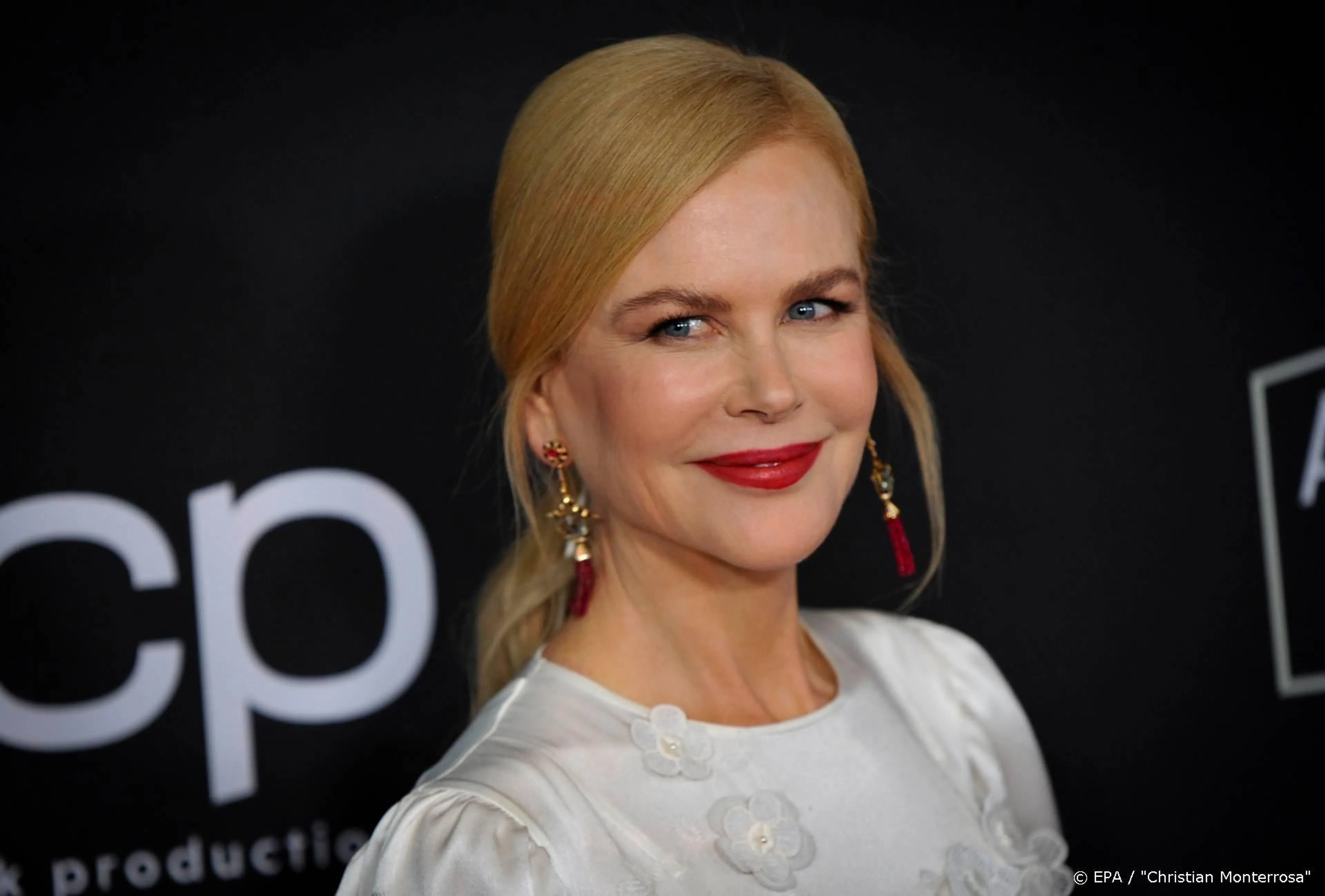 Nicole Kidman weer bijna op de been na breken enkel