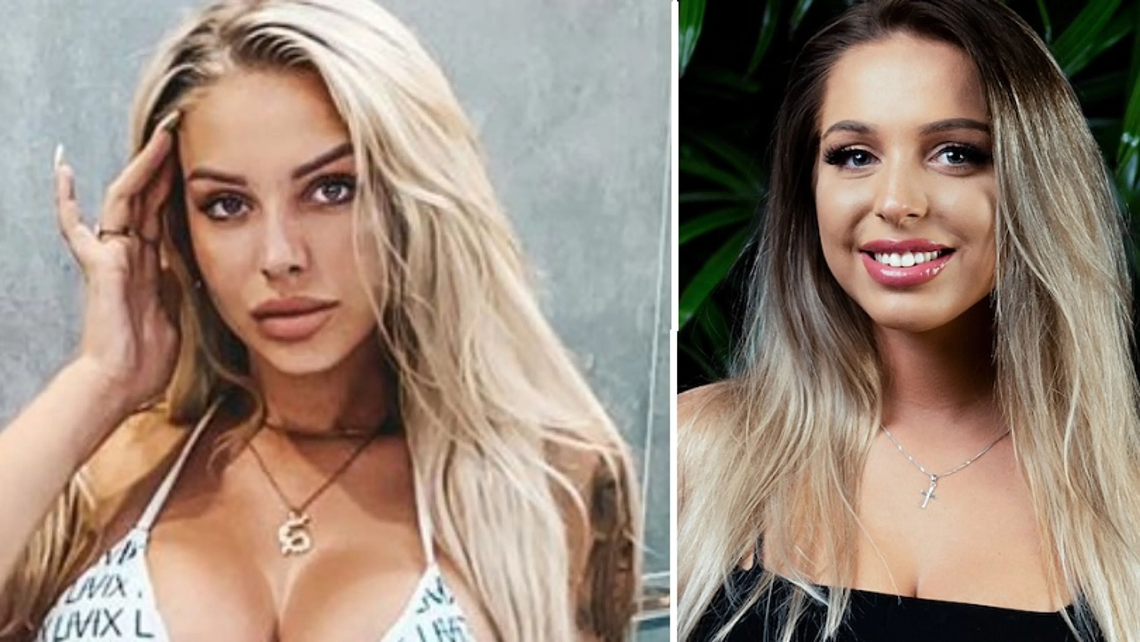 WTF: Opgespoten lippen Temptation-Shirley op ontploffen