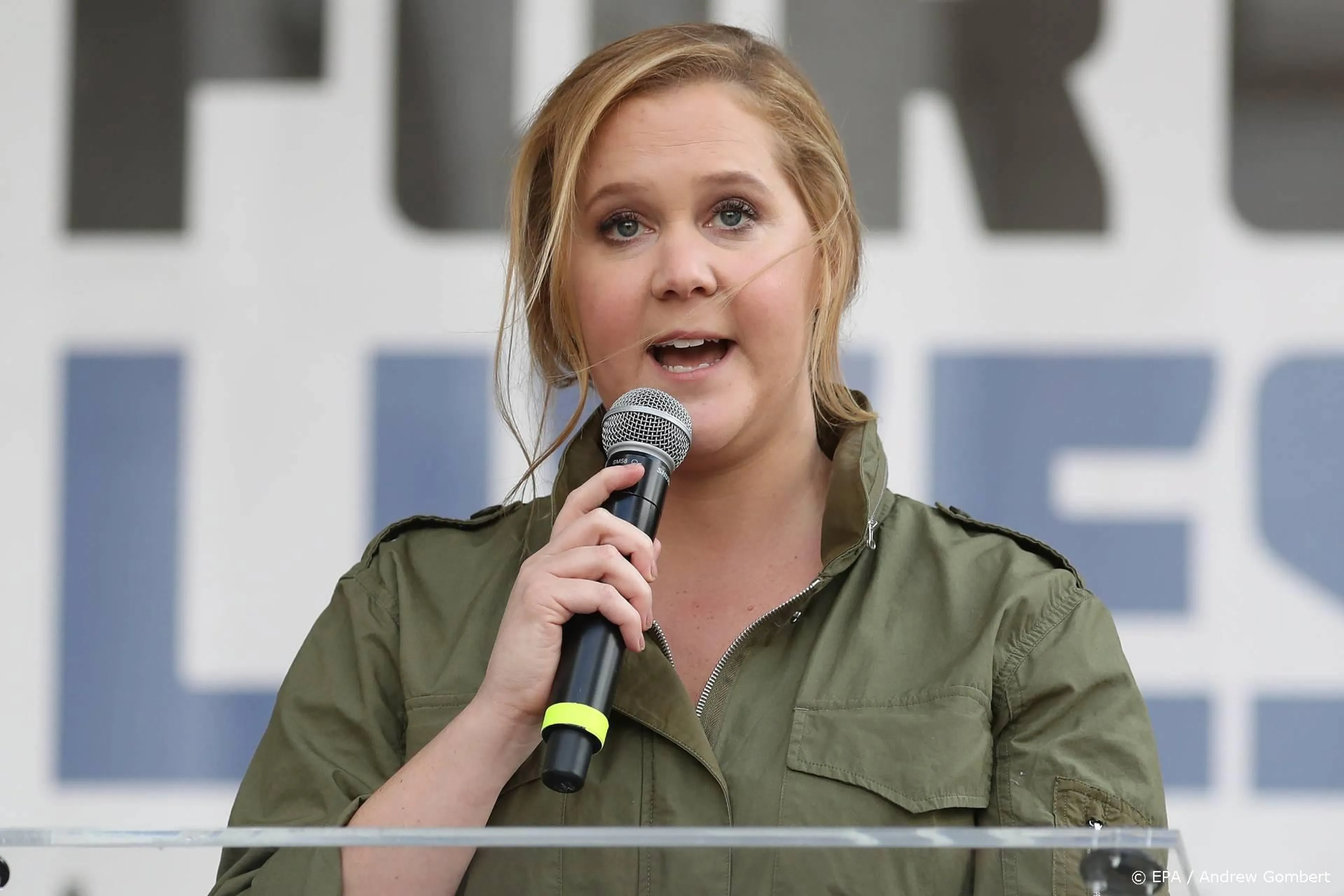 Amy Schumer: ik wil eerlijk zijn over liposuctie