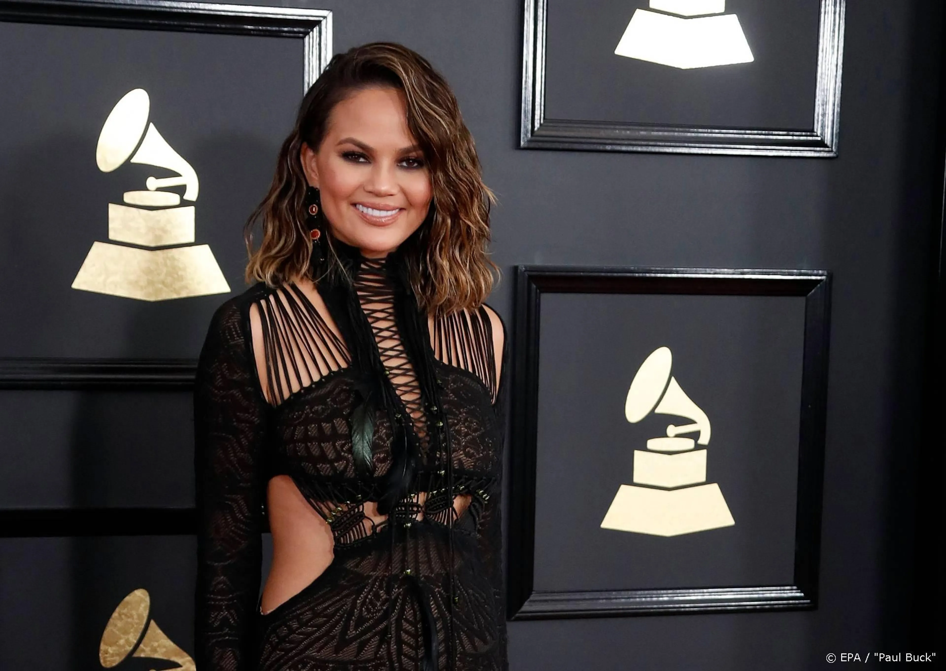 Chrissy Teigen deelt bewijs van borstoperatie