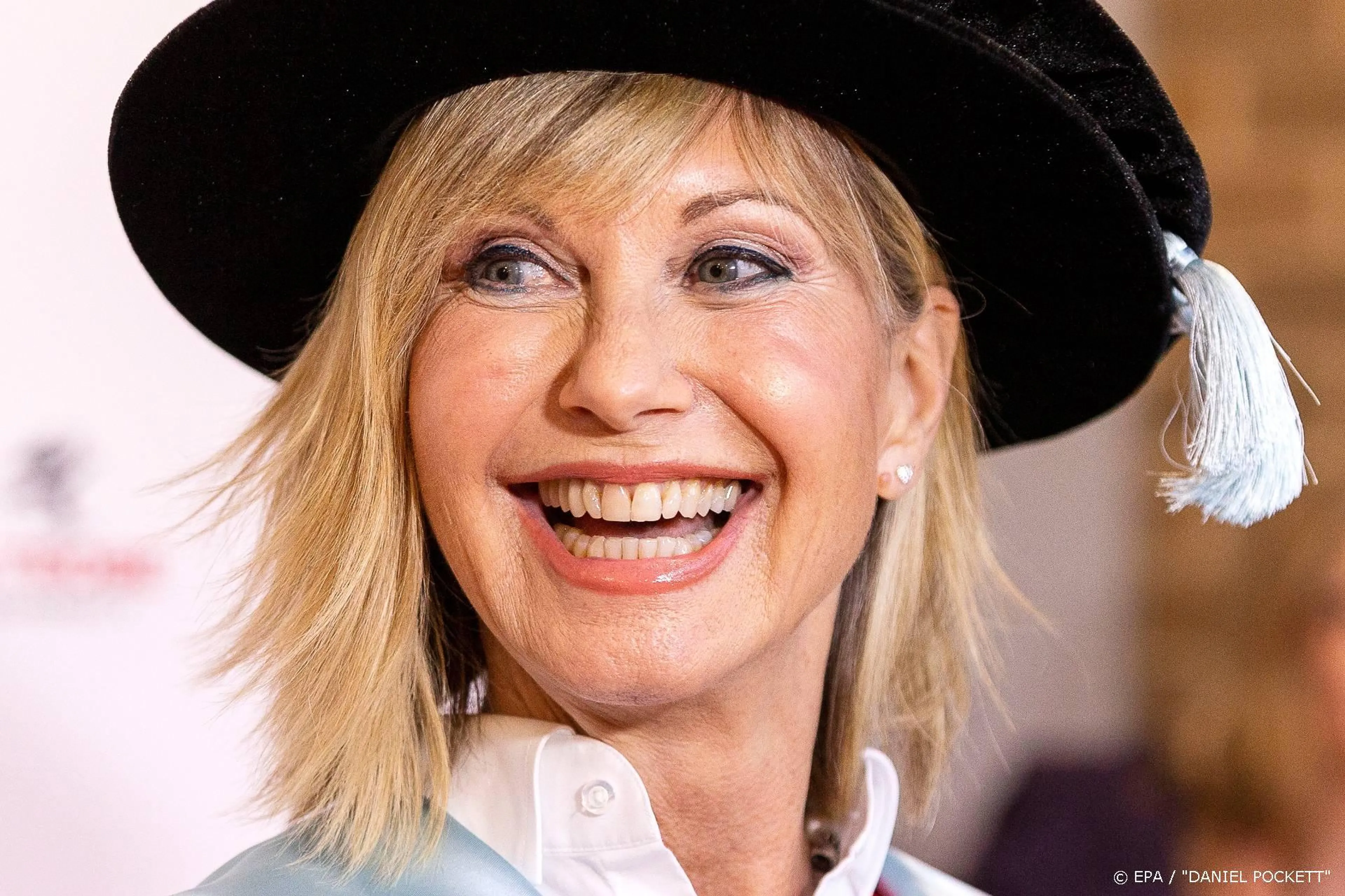 Tumoren Olivia Newton-John worden kleiner
