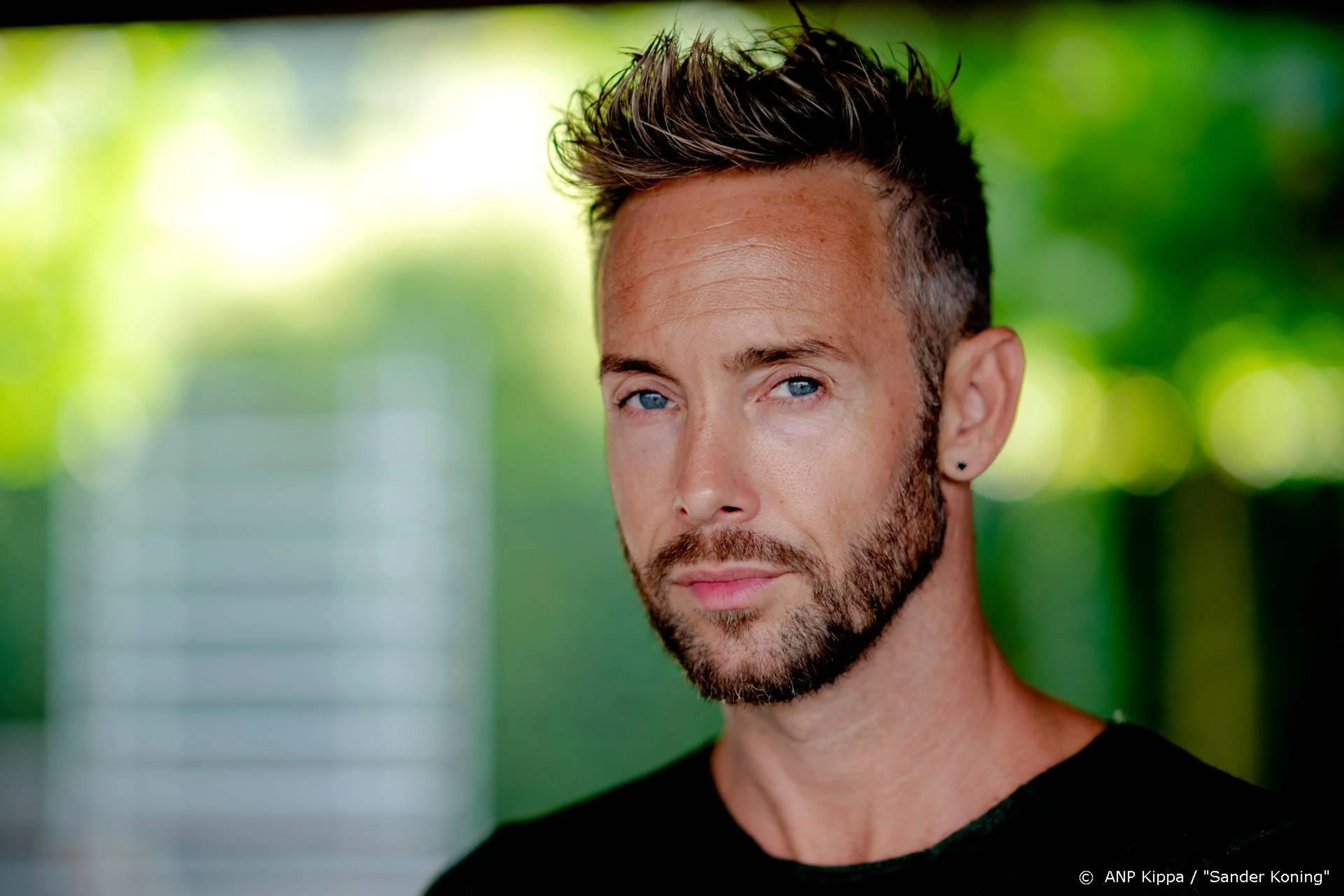 Charly Luske ondergaat haartransplantatie