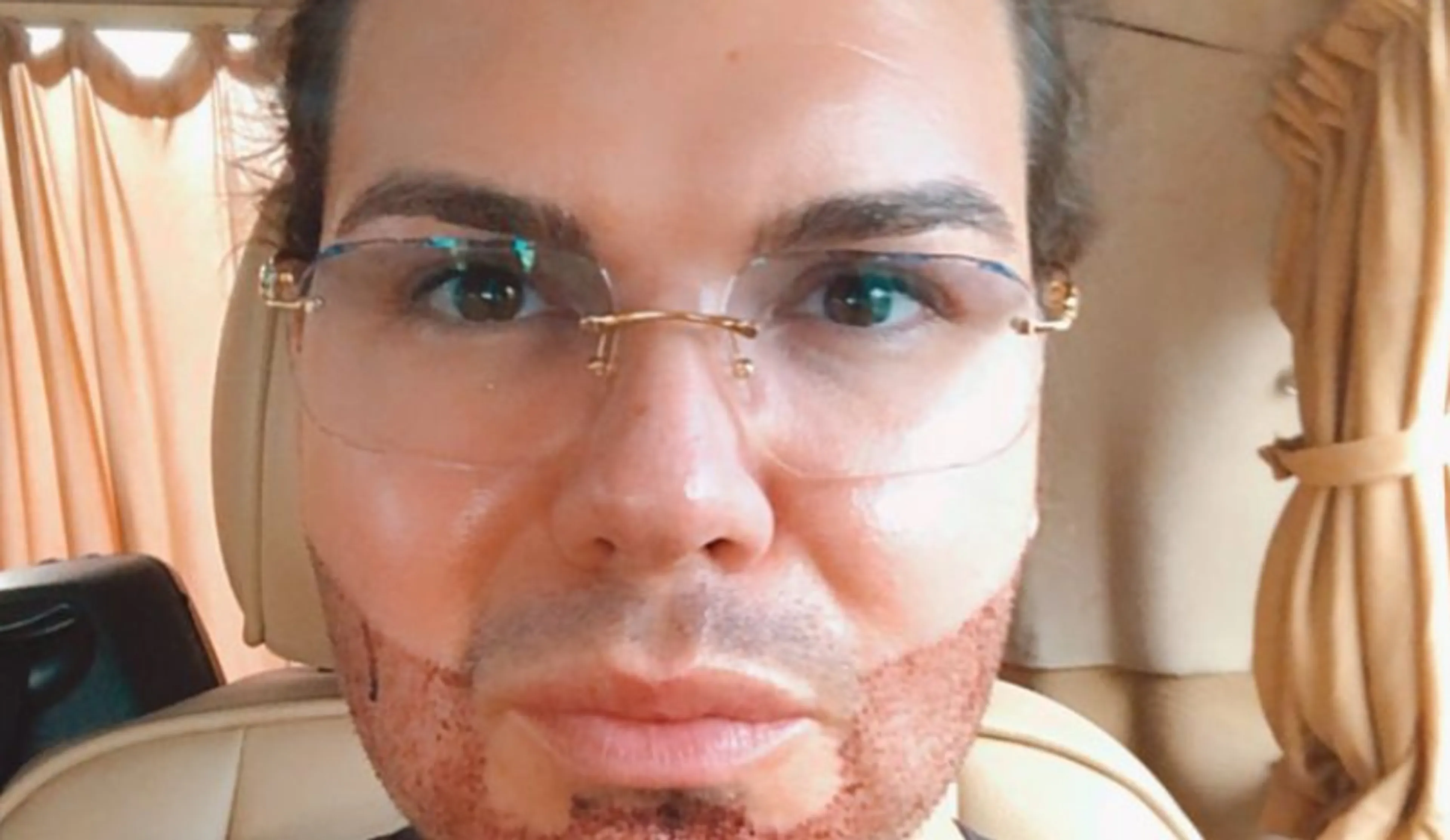 Roy Donders bijt van zich af na kritiek op baard