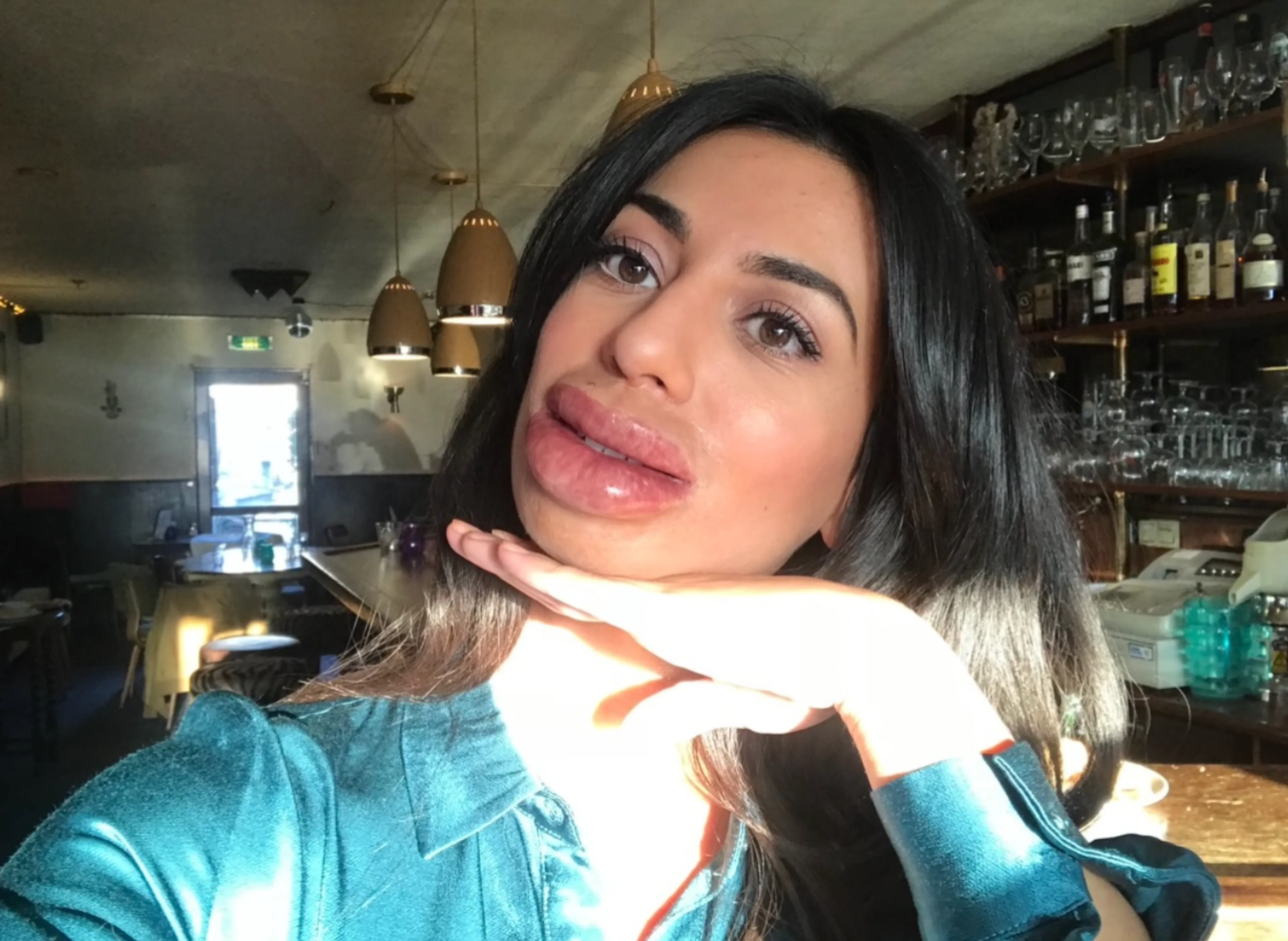Een lipfillertje te veel voor Hila Noorzai?