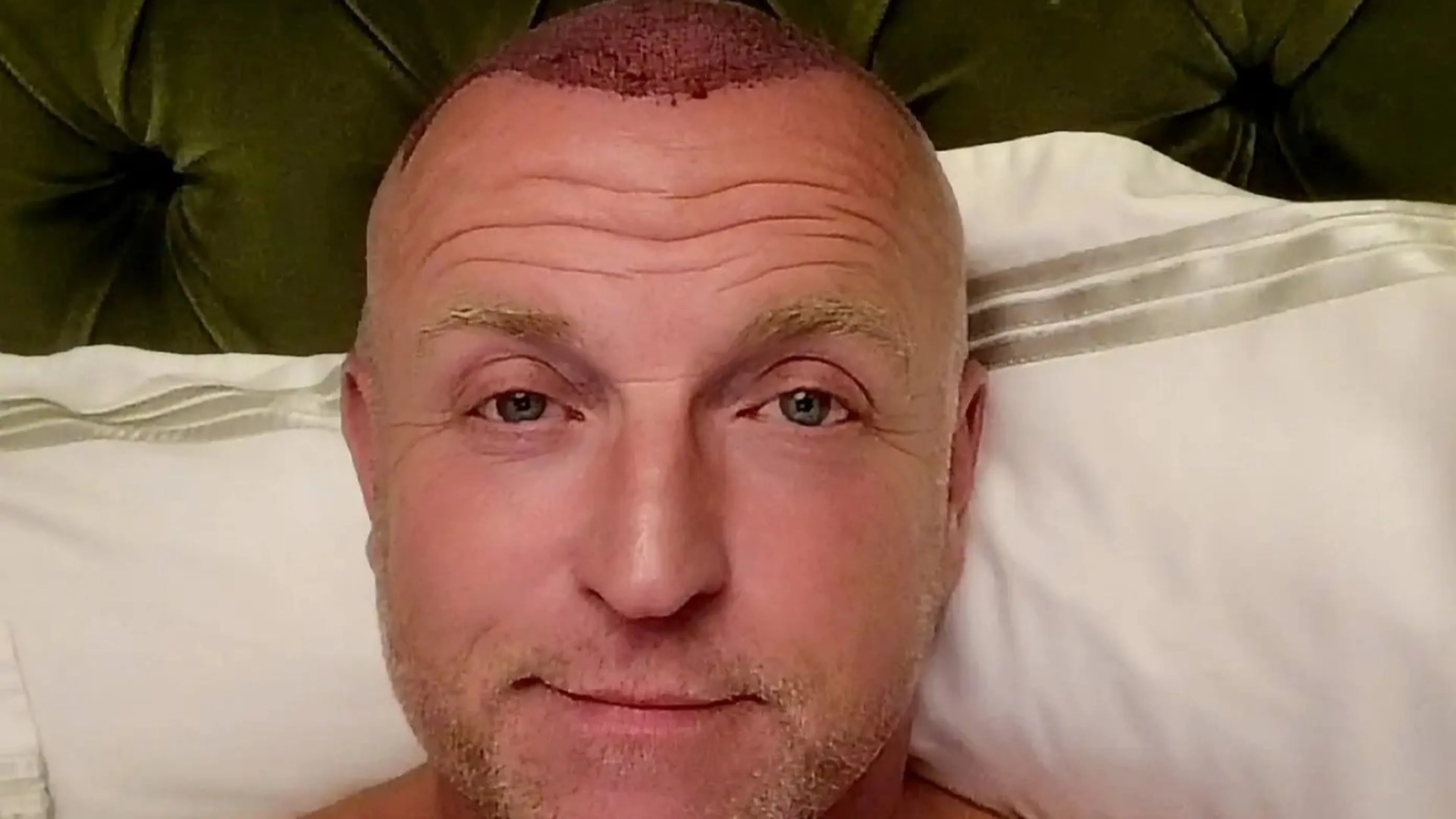 ZIEN: Gordon geeft haarupdate