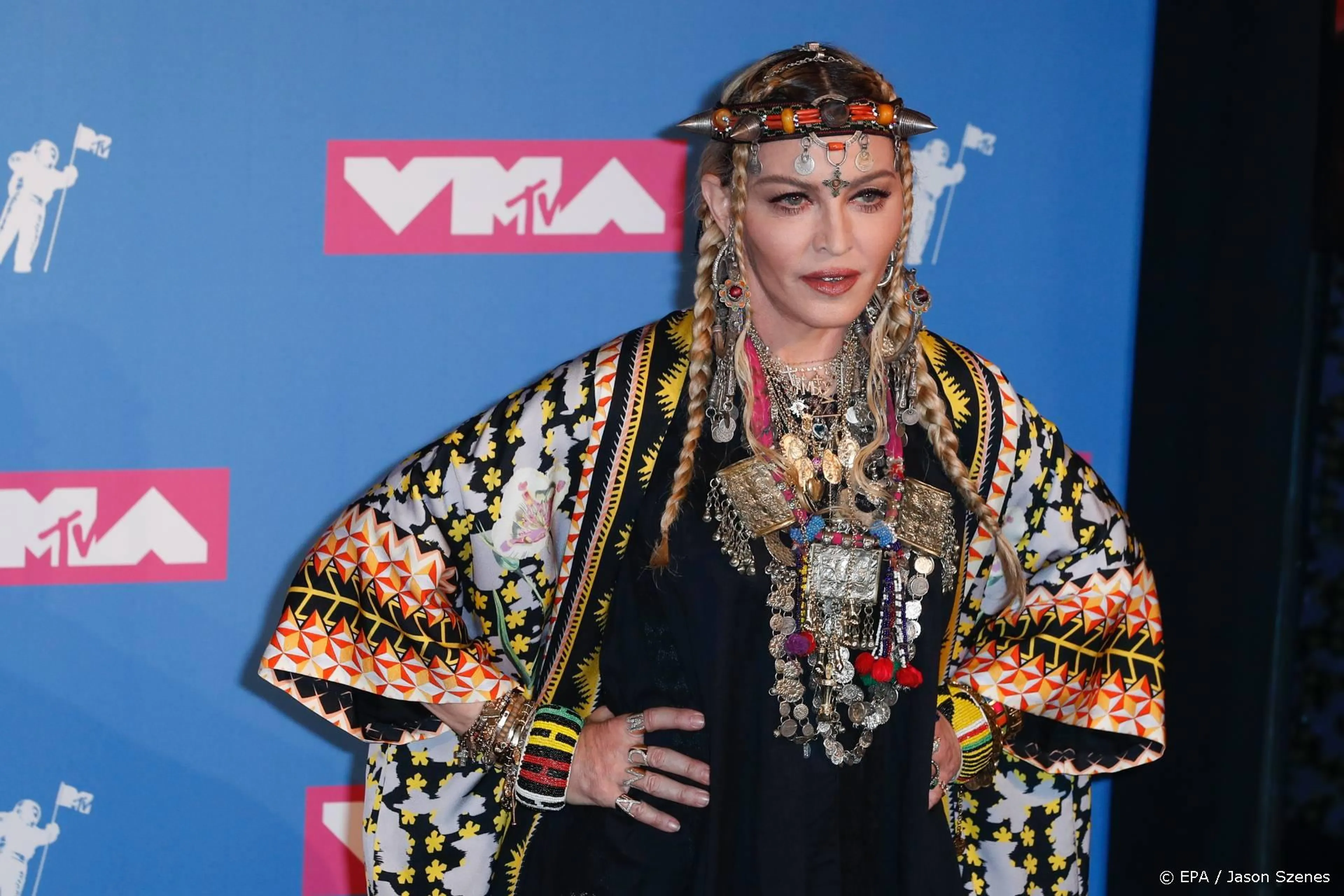 Madonna eindelijk hersteld van knieblessure