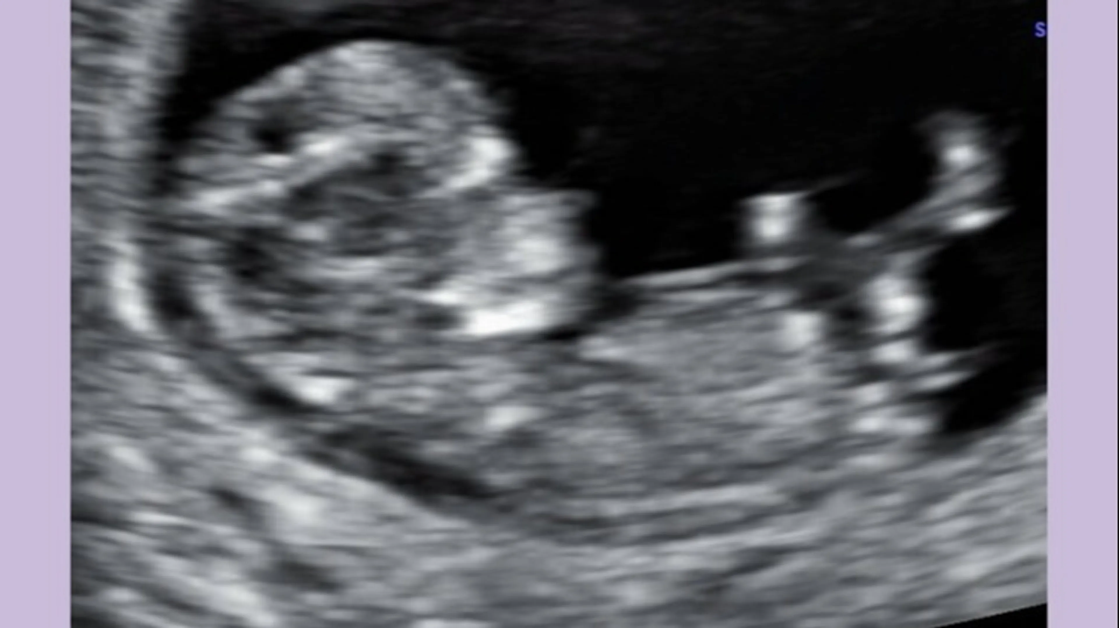 Babynieuws! Bekende musicalactrice in verwachting