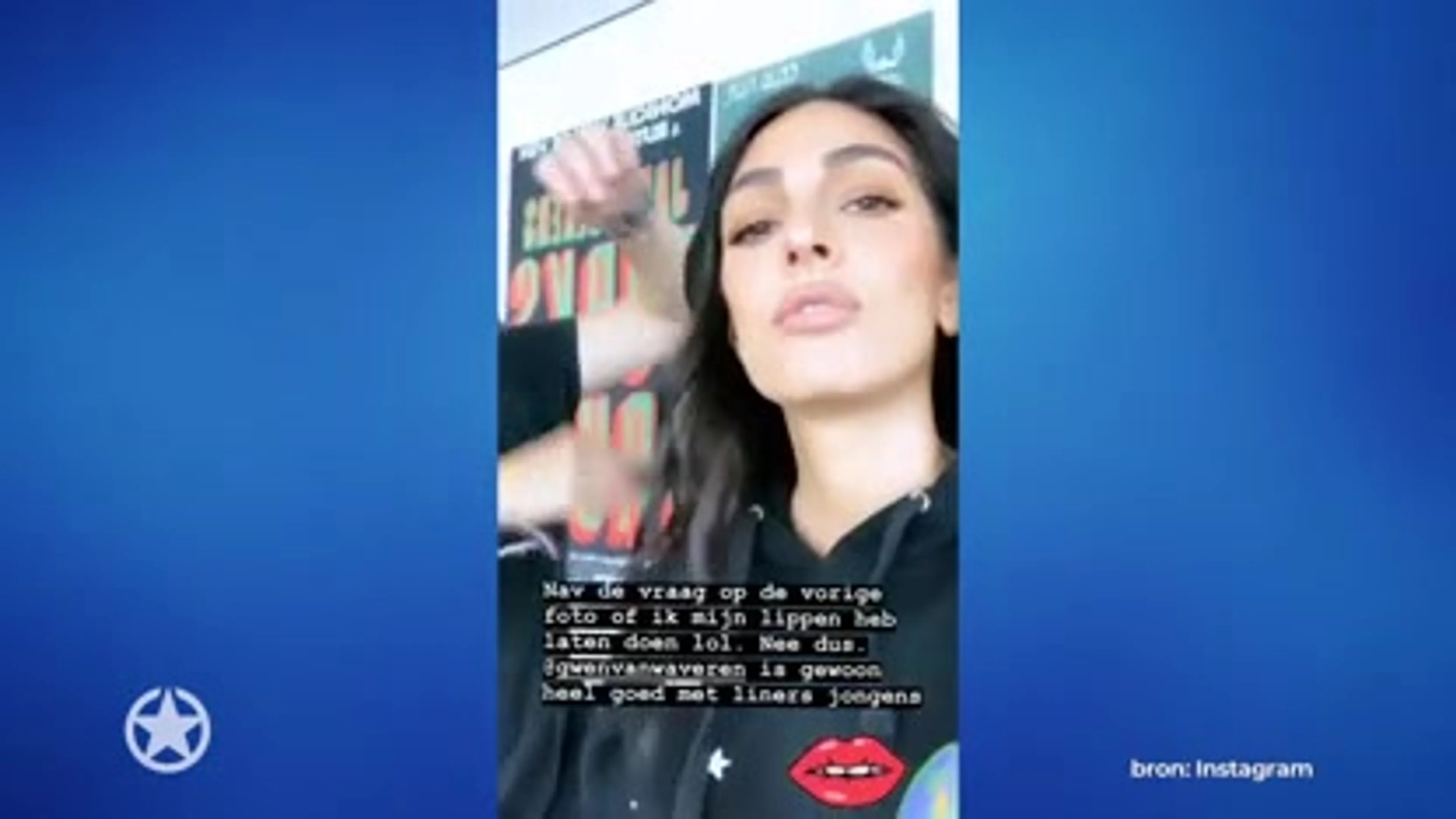 Anna Nooshin onder vuur vanwege 'vollere lippen'