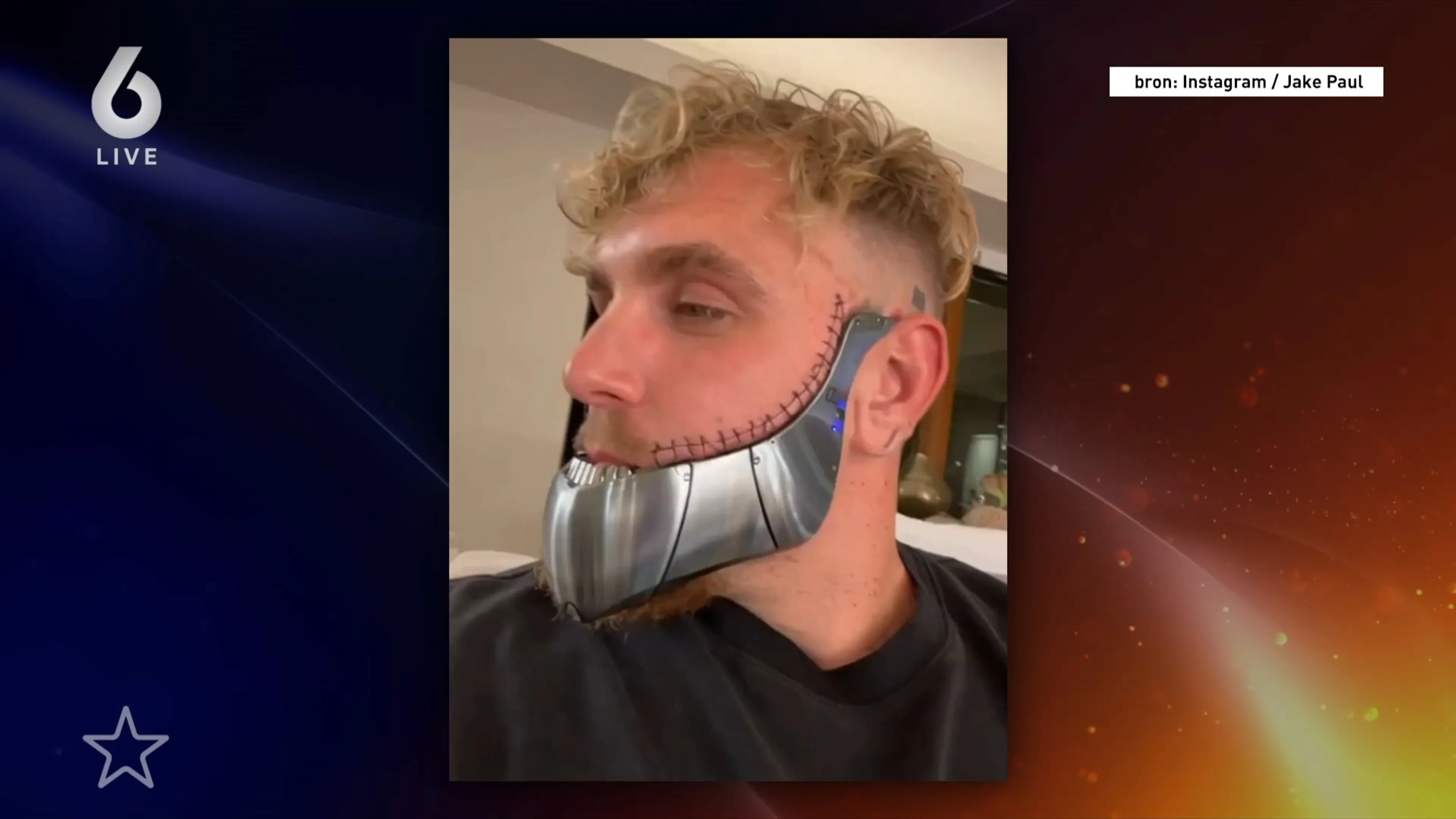 Jake Paul kampt met complicaties na kaakbreuk, kan hij ooit nog gaan boksen?
