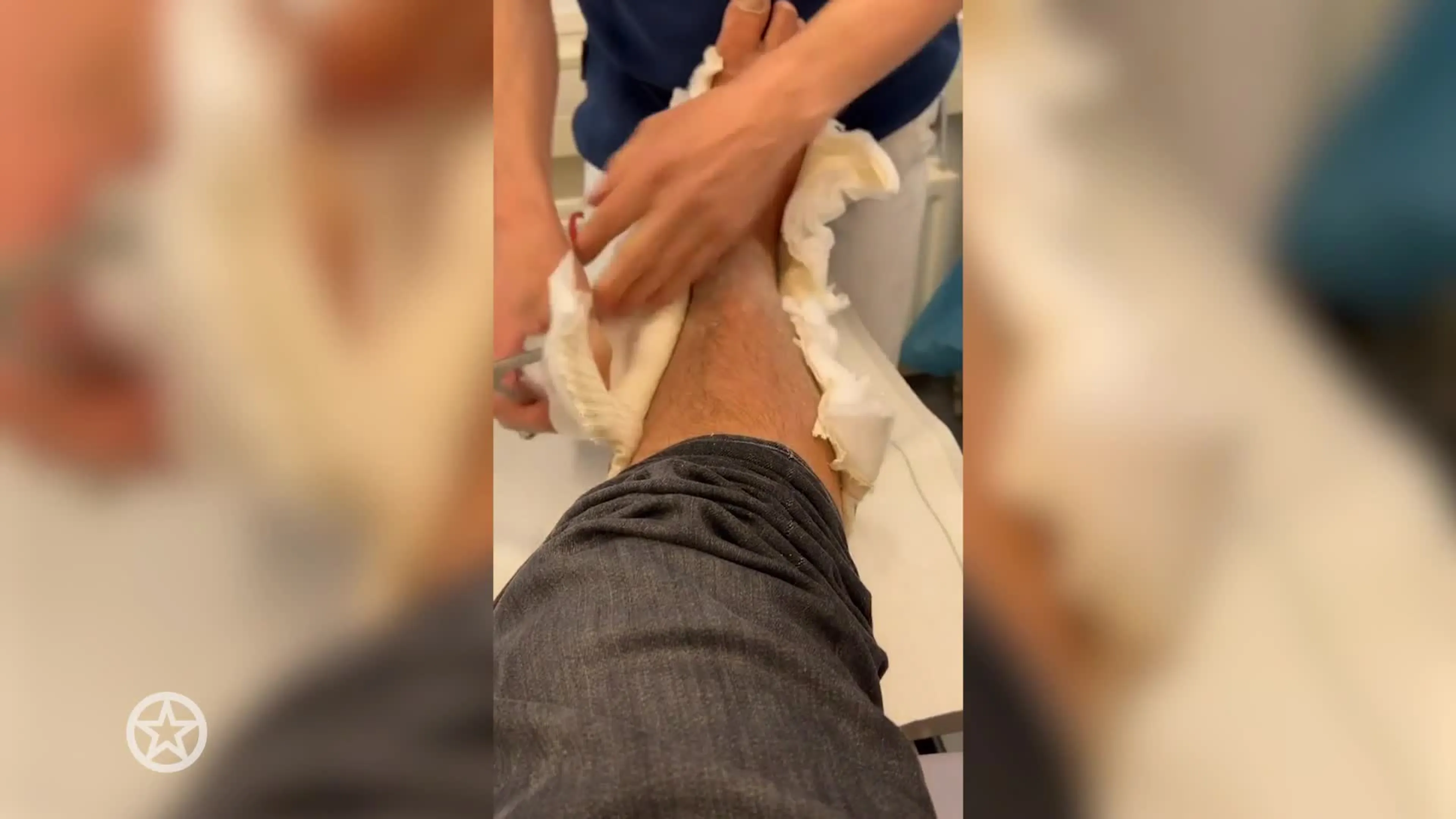 Mark Gillis uit het gips