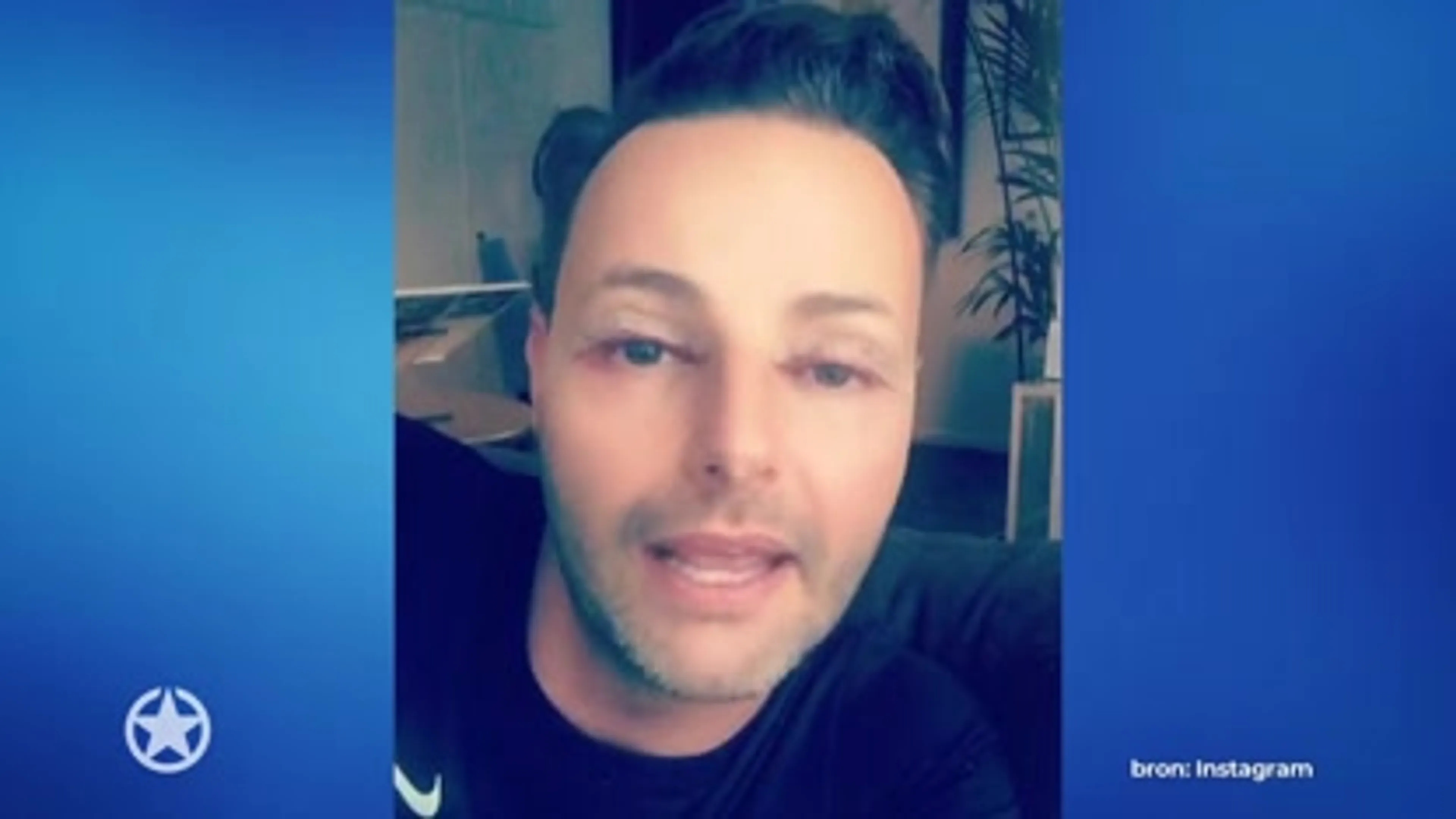 Deze mannelijke BN'ers hebben geen moeite met plastische chirurgie