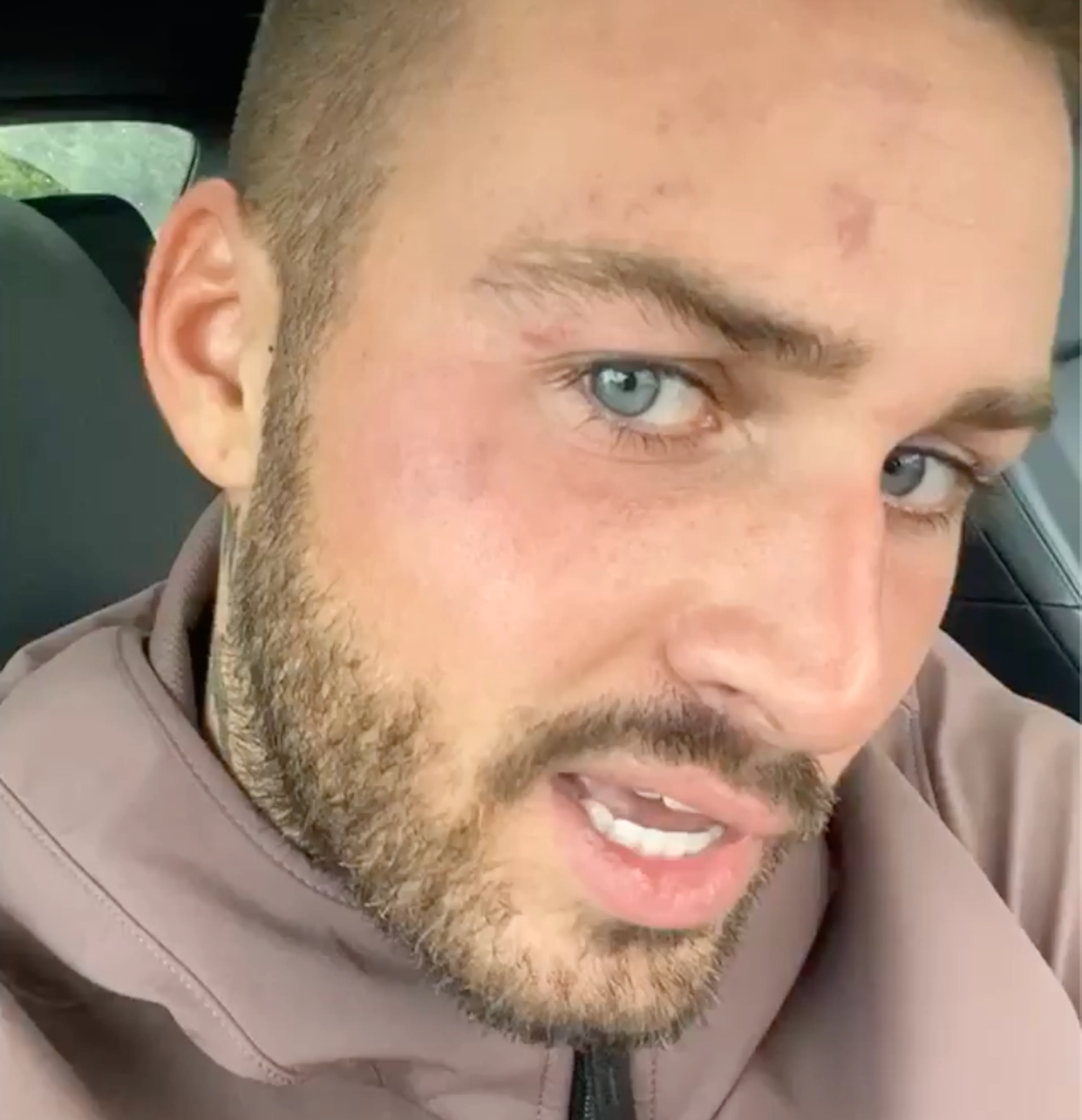 Dave Roelvink deelt blauwe plekken na pak slaag