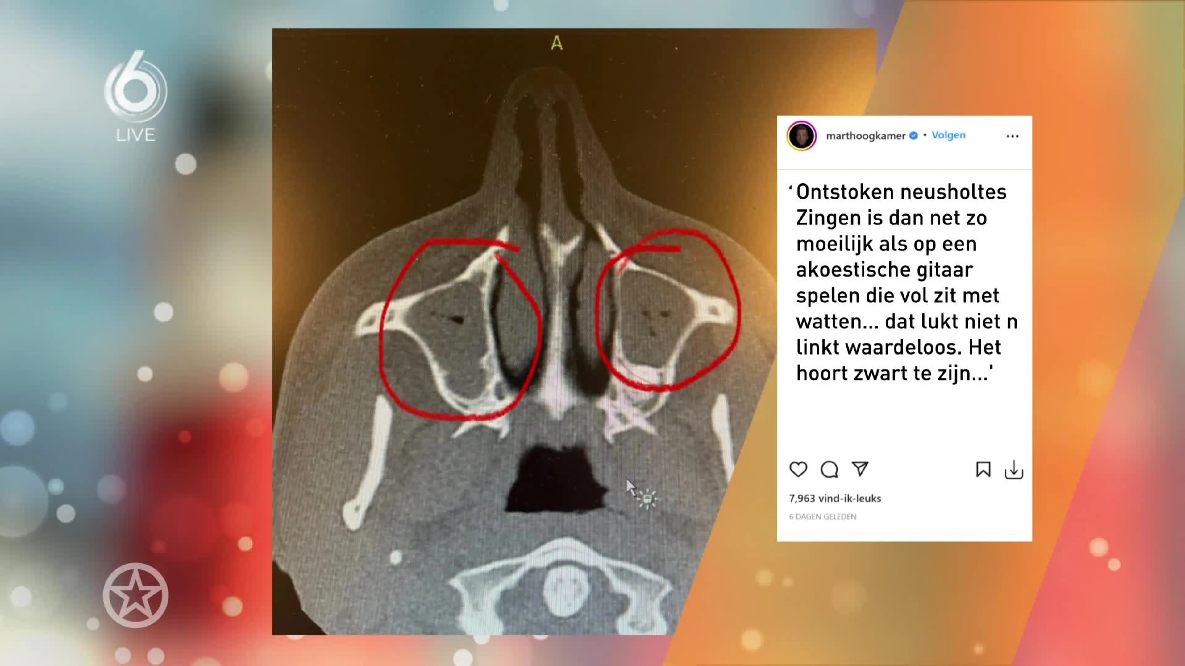 Mart Hoogkamer gaat weer 'vlammen'