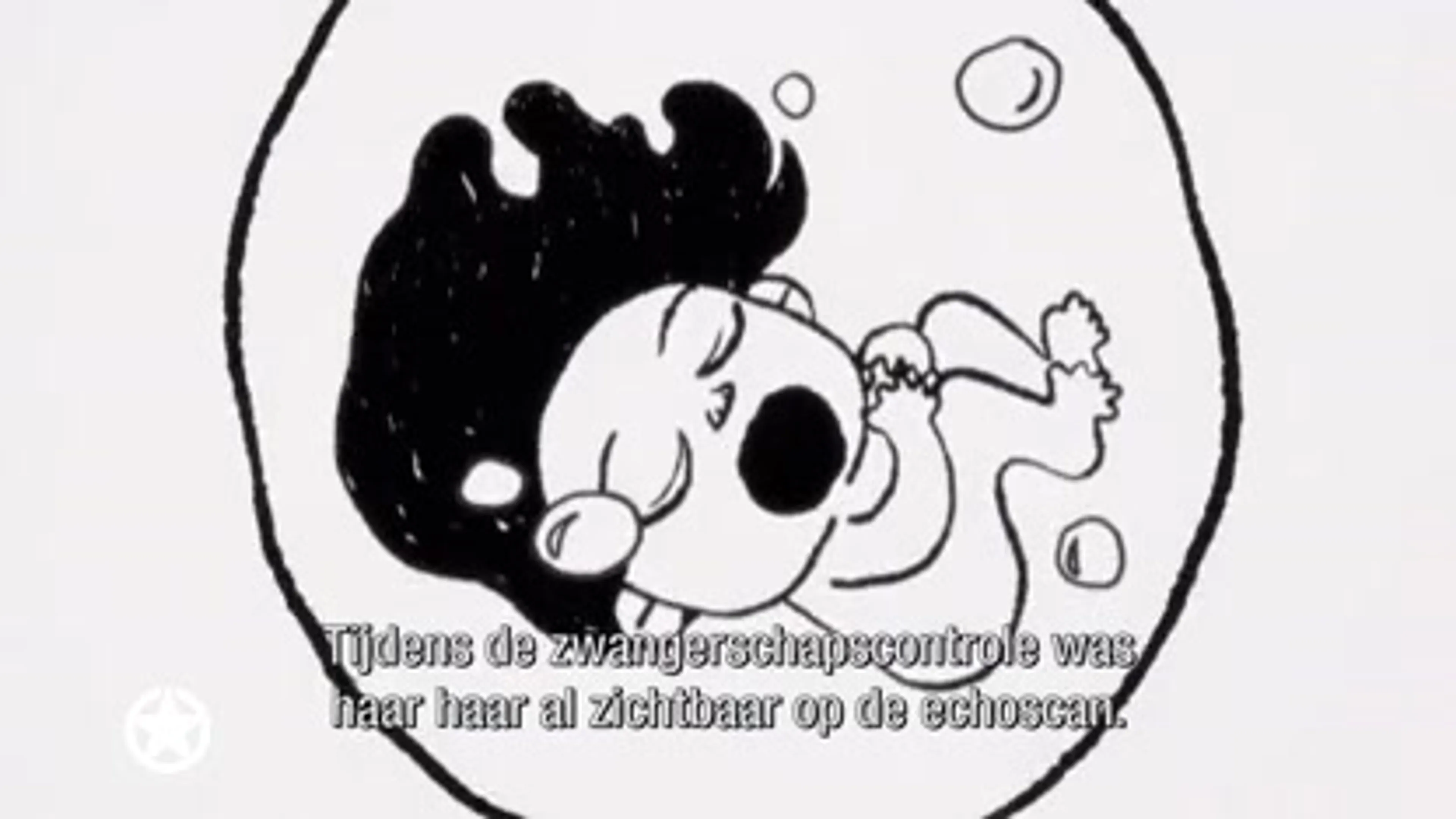 Baby Chanco nu al supermodel dankzij haardos