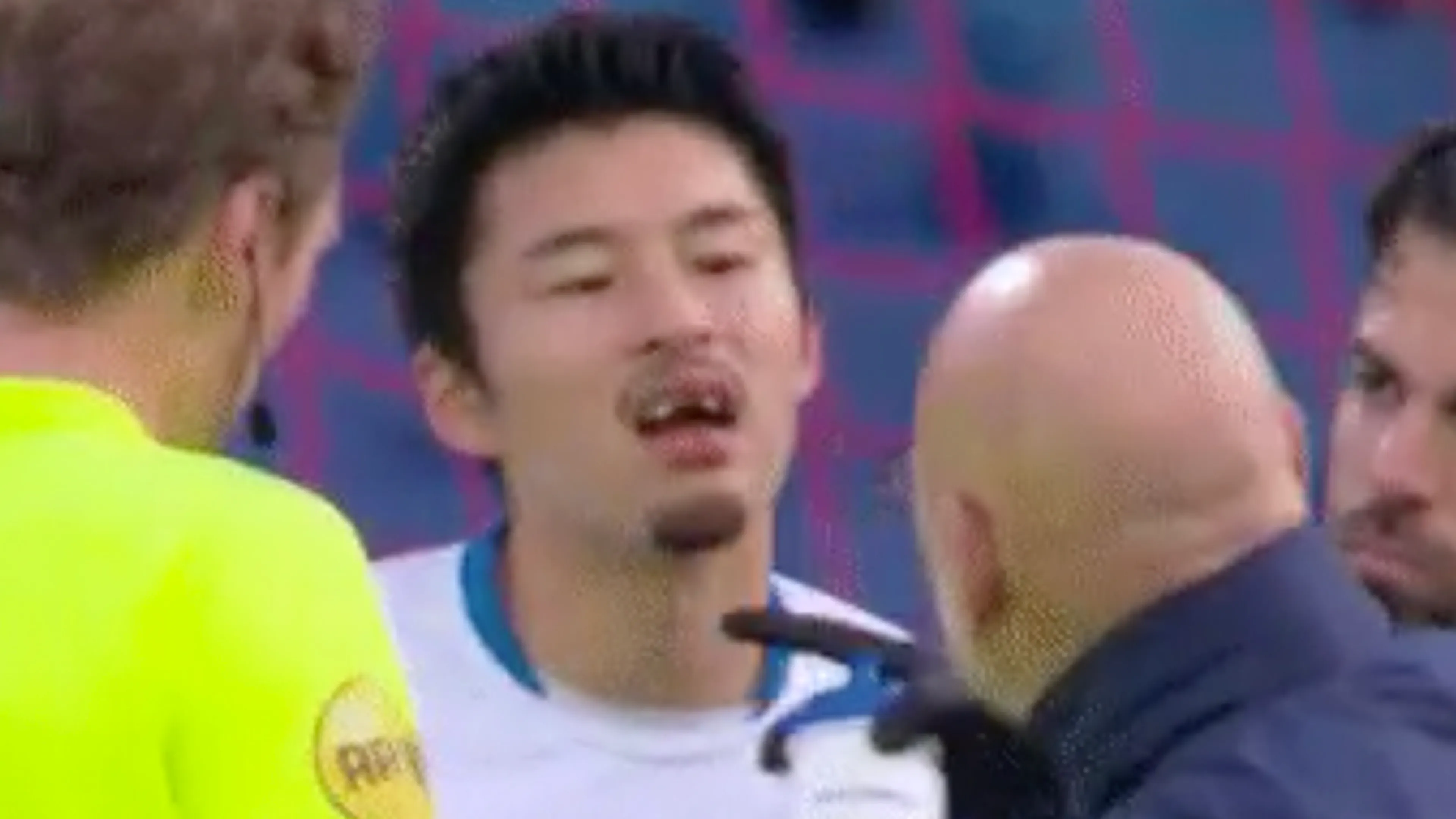 Pijnlijk: PEC Zwolle-speler Yuta Nakayama verliest voortanden tegen Feyenoord