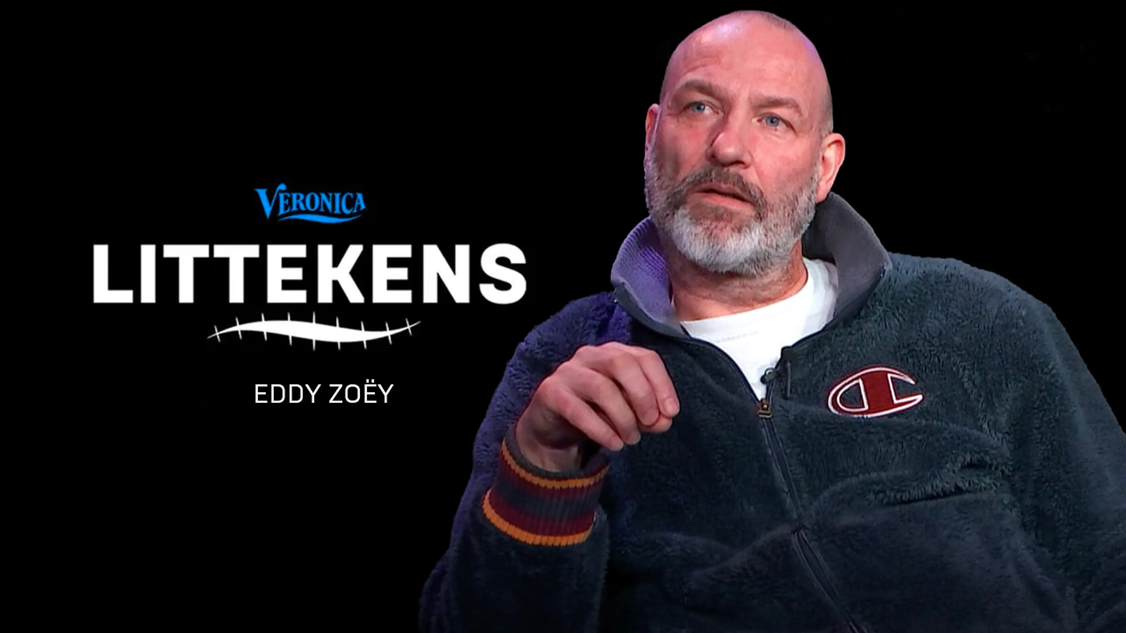 Littekens #4: Eddy Zoëy heeft héél veel littekens