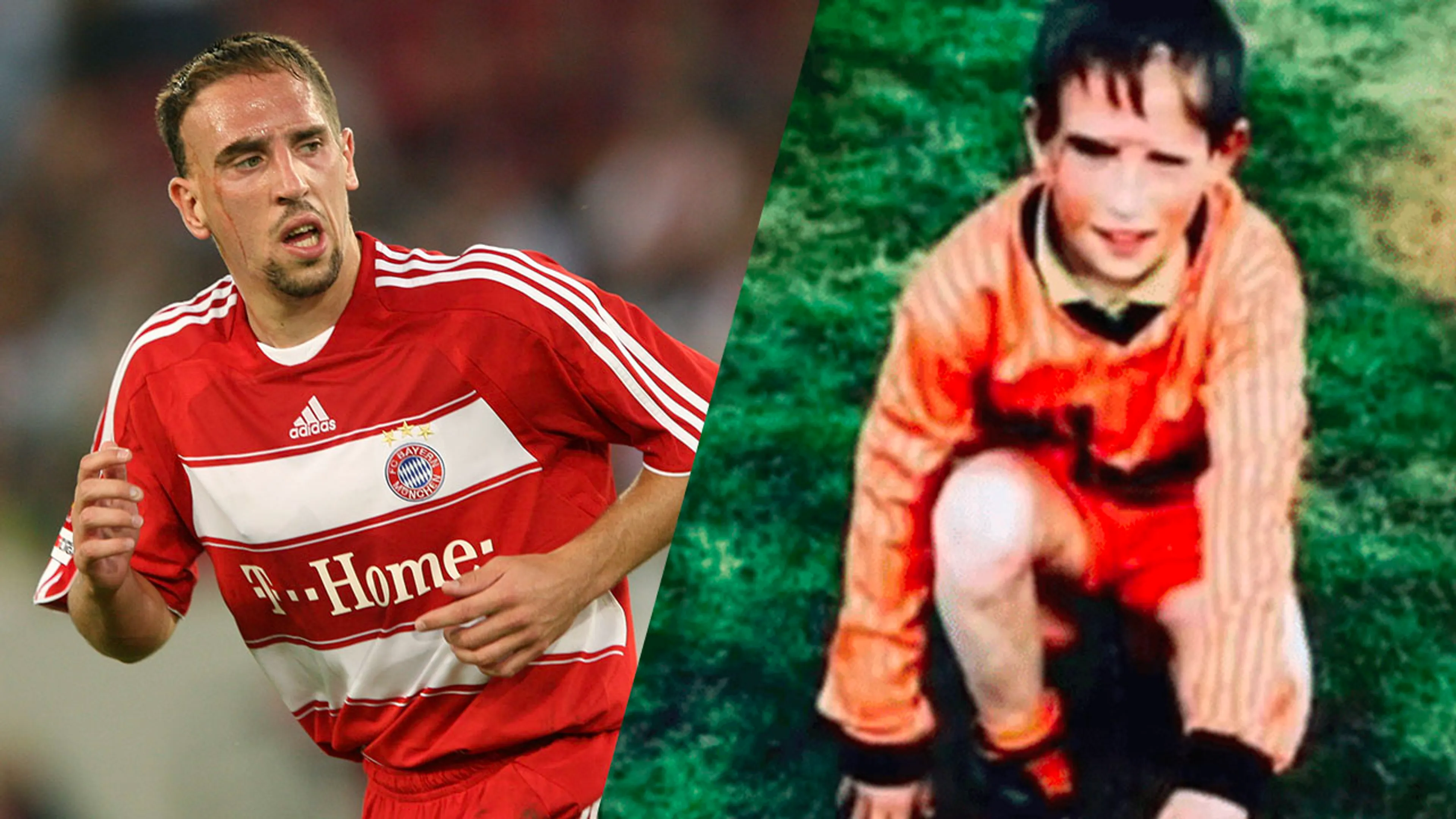 Dit is het dramatische verhaal achter de littekens van Franck Ribéry