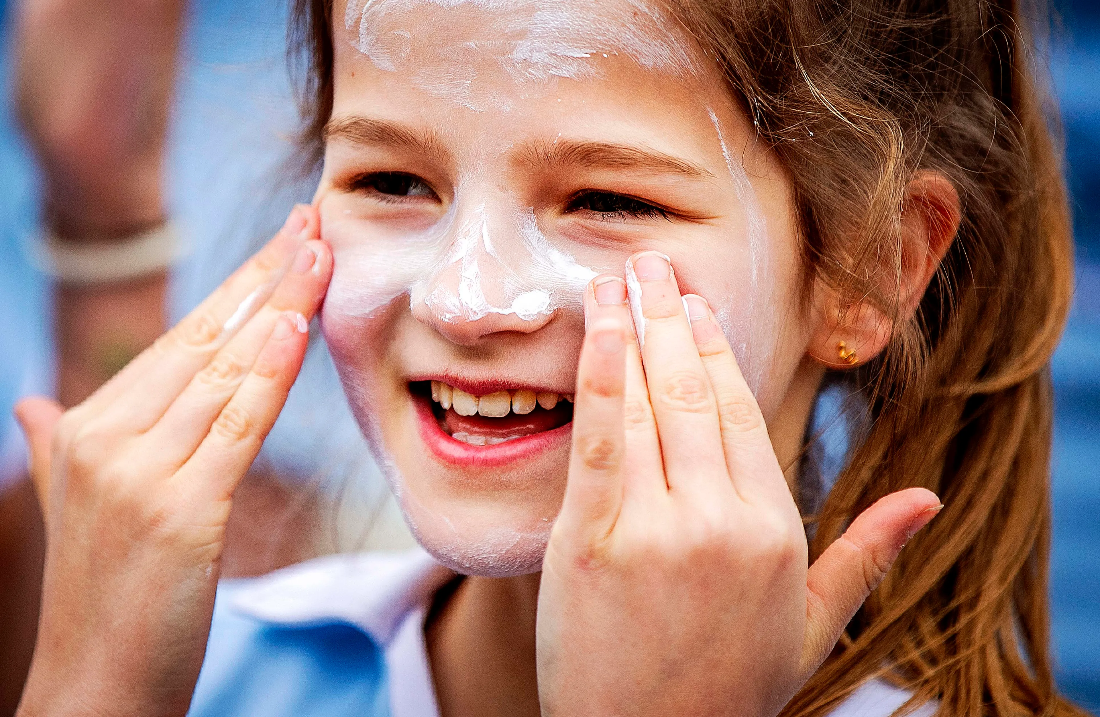 Herkenbaar: deze zonnebrand-irritaties heeft iedereen