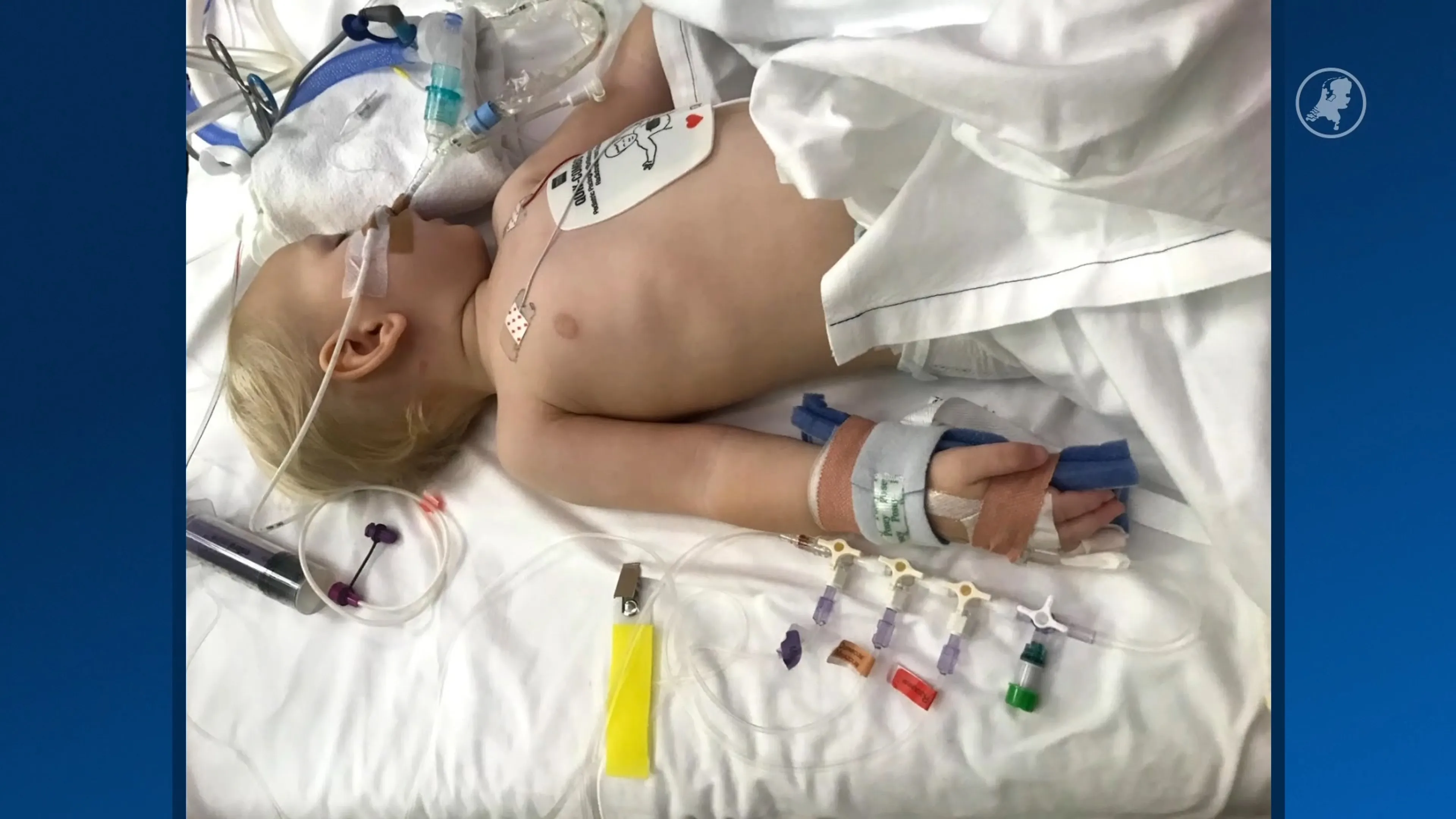 Juwe (7) werd levensgevaarlijk ziek na het inslikken van een batterij