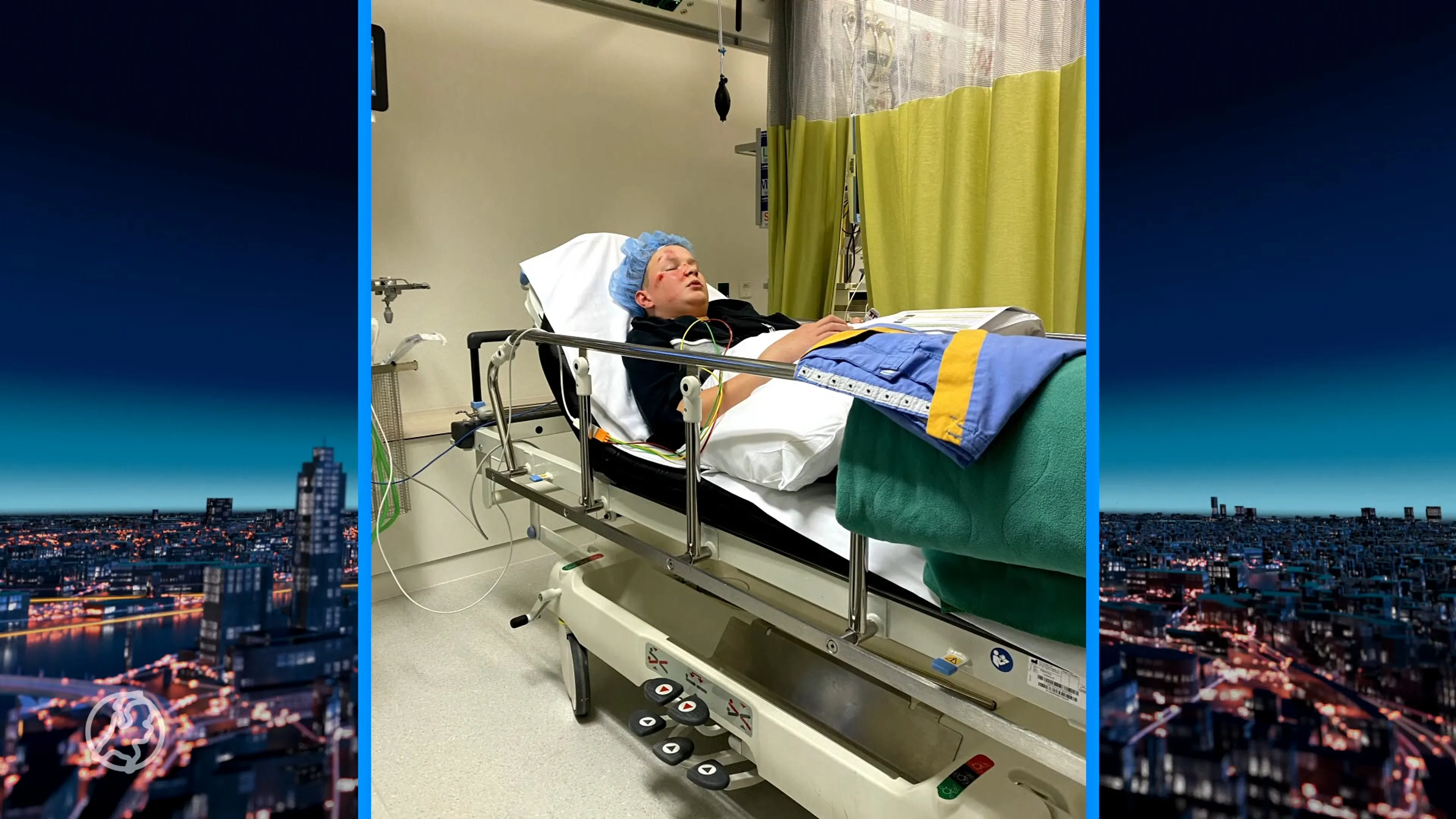 Christiaan (14) was onderweg van schoolreisje, maar werd opeens van fiets gereden