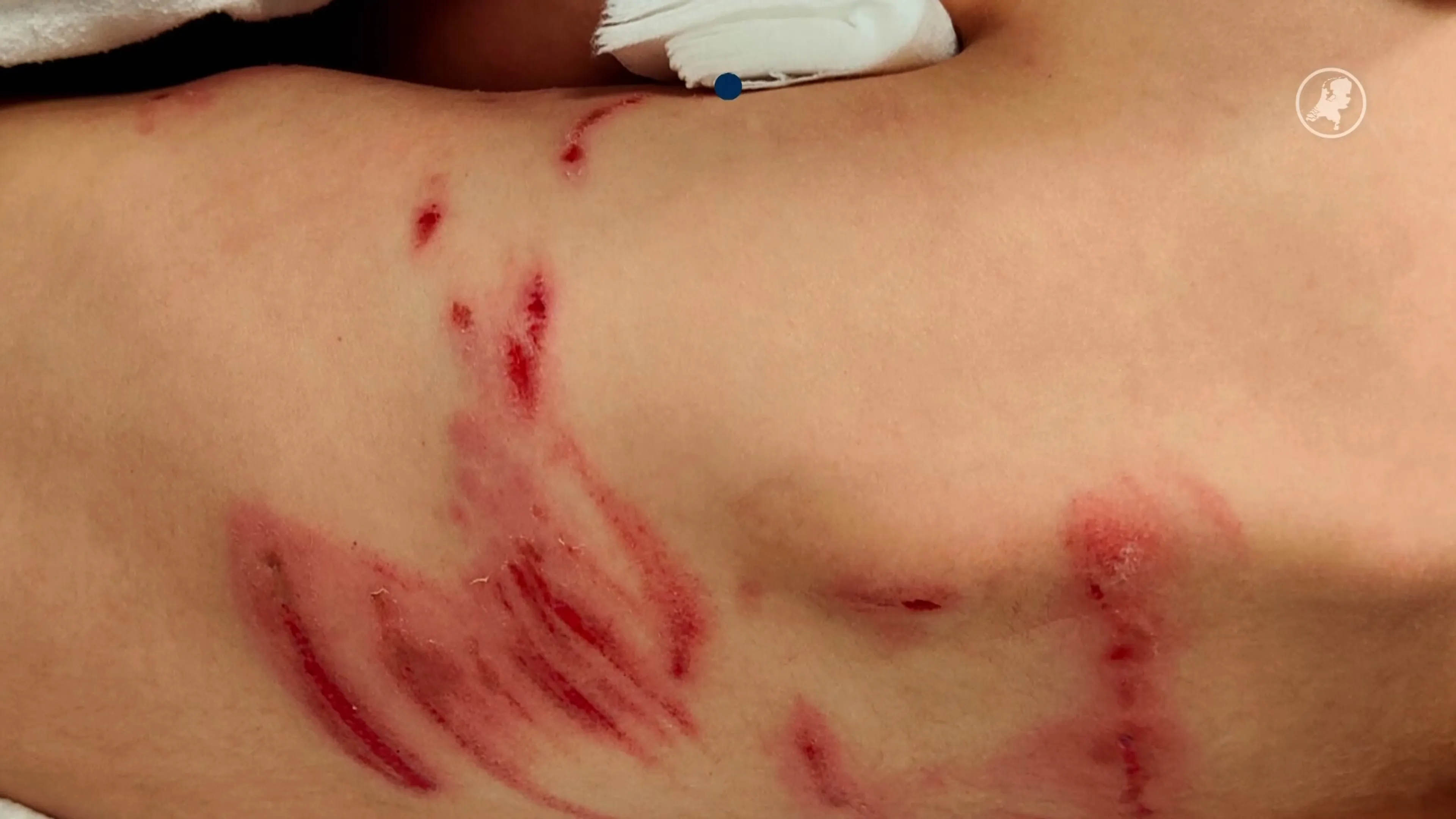 Jongetje (6) thuis na mogelijk bijtincident met wolf: 'Neem kinderen niet mee naar gebied'