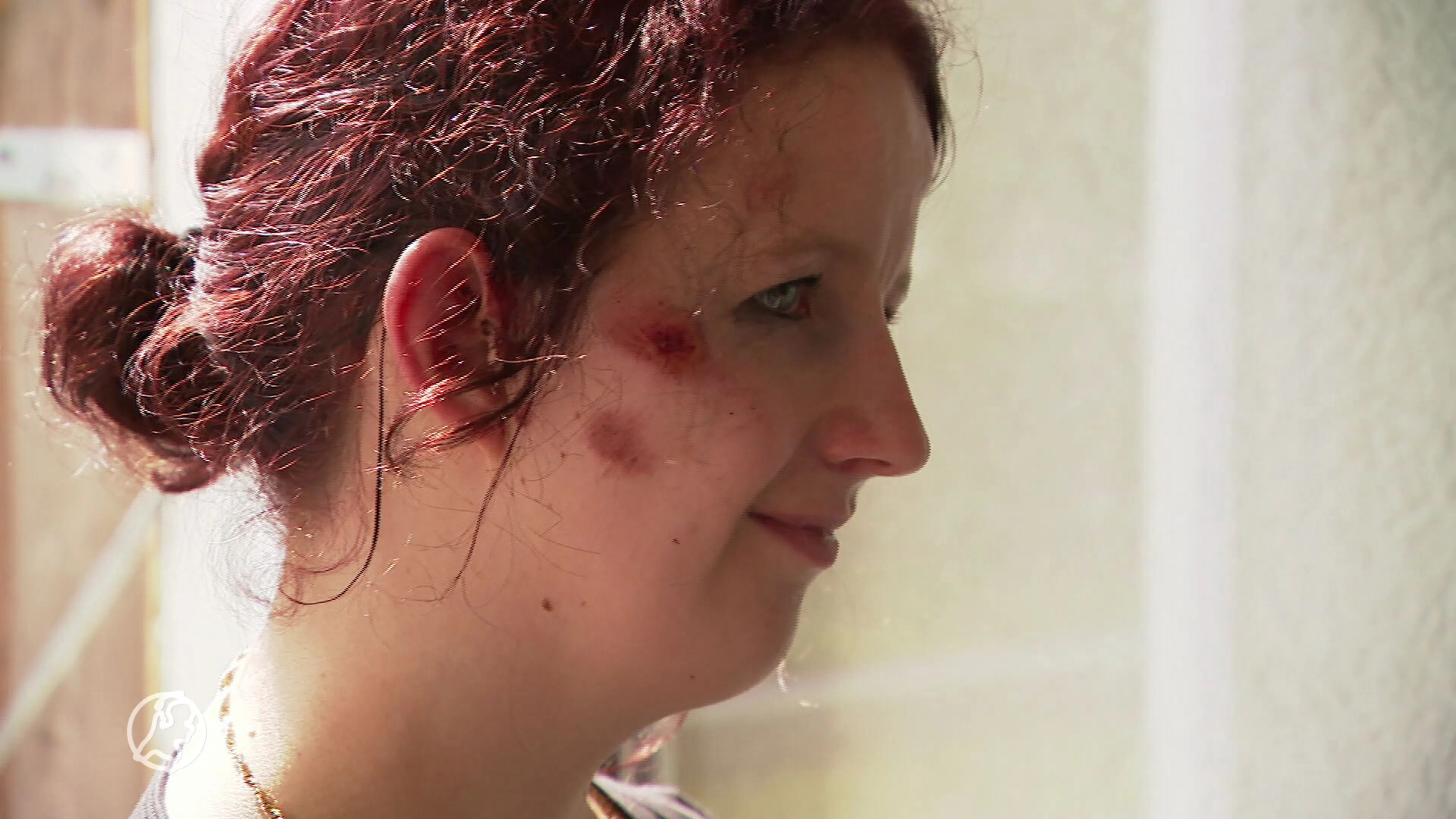 Bianca (24) werd geschept door een auto en onder het bloed achtergelaten