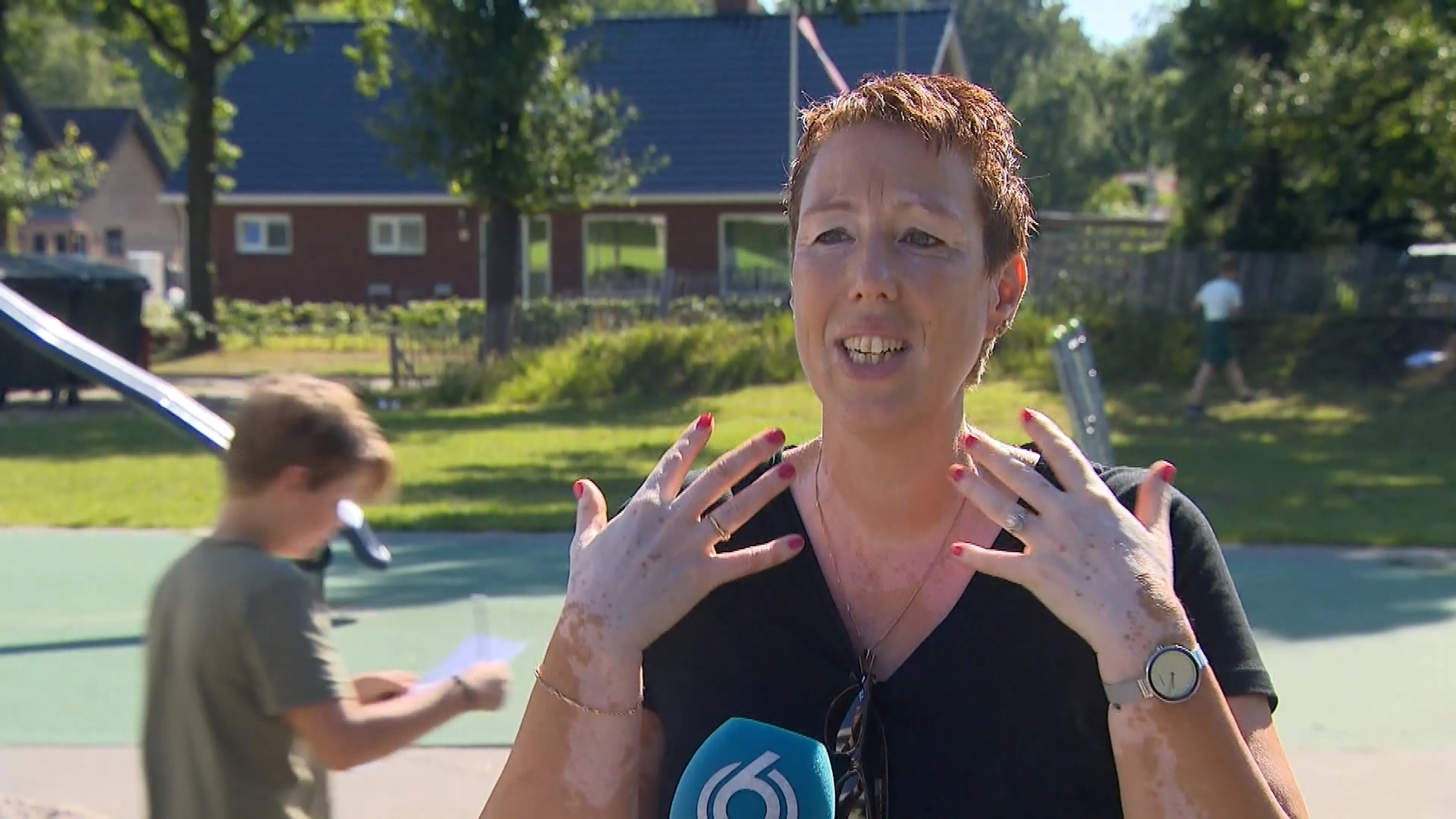 Het is vandaag Wereld Vitiligo Dag: 'Vraag gewoon naar de vlekken op mijn huid'
