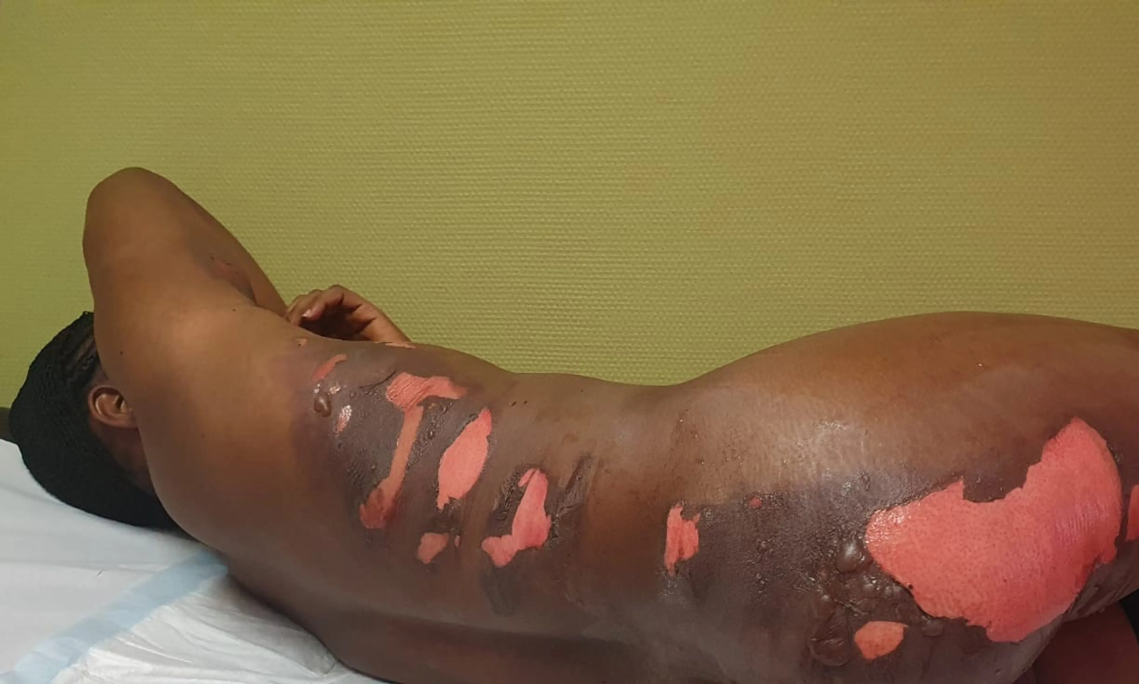 Anti-homogeweld in Brabants azc: lesbische vrouw krijgt kokend water over zich heen