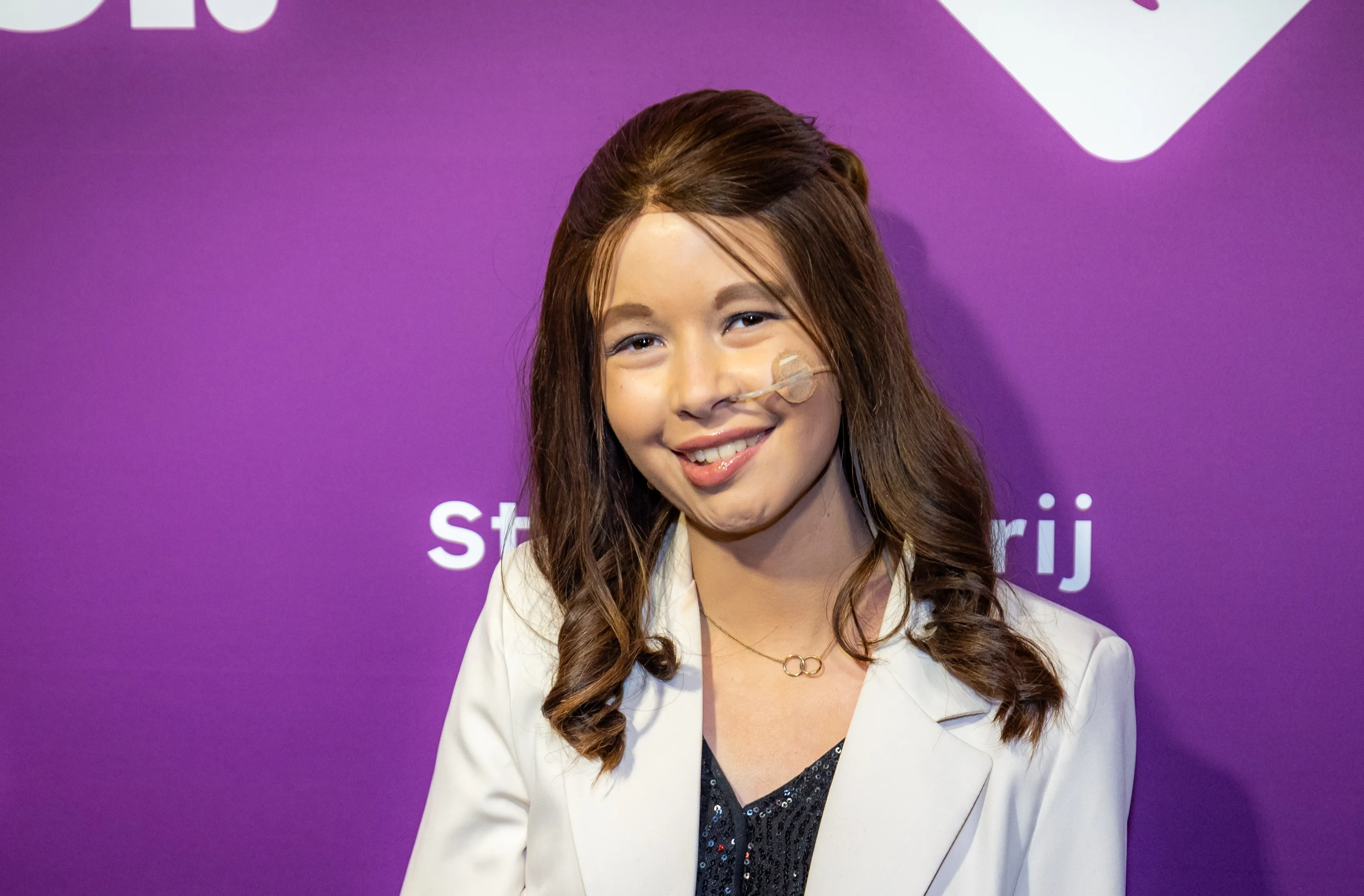 Jade Kops deelt aangrijpende foto van tumor: 'Bult wordt met de dag groter'