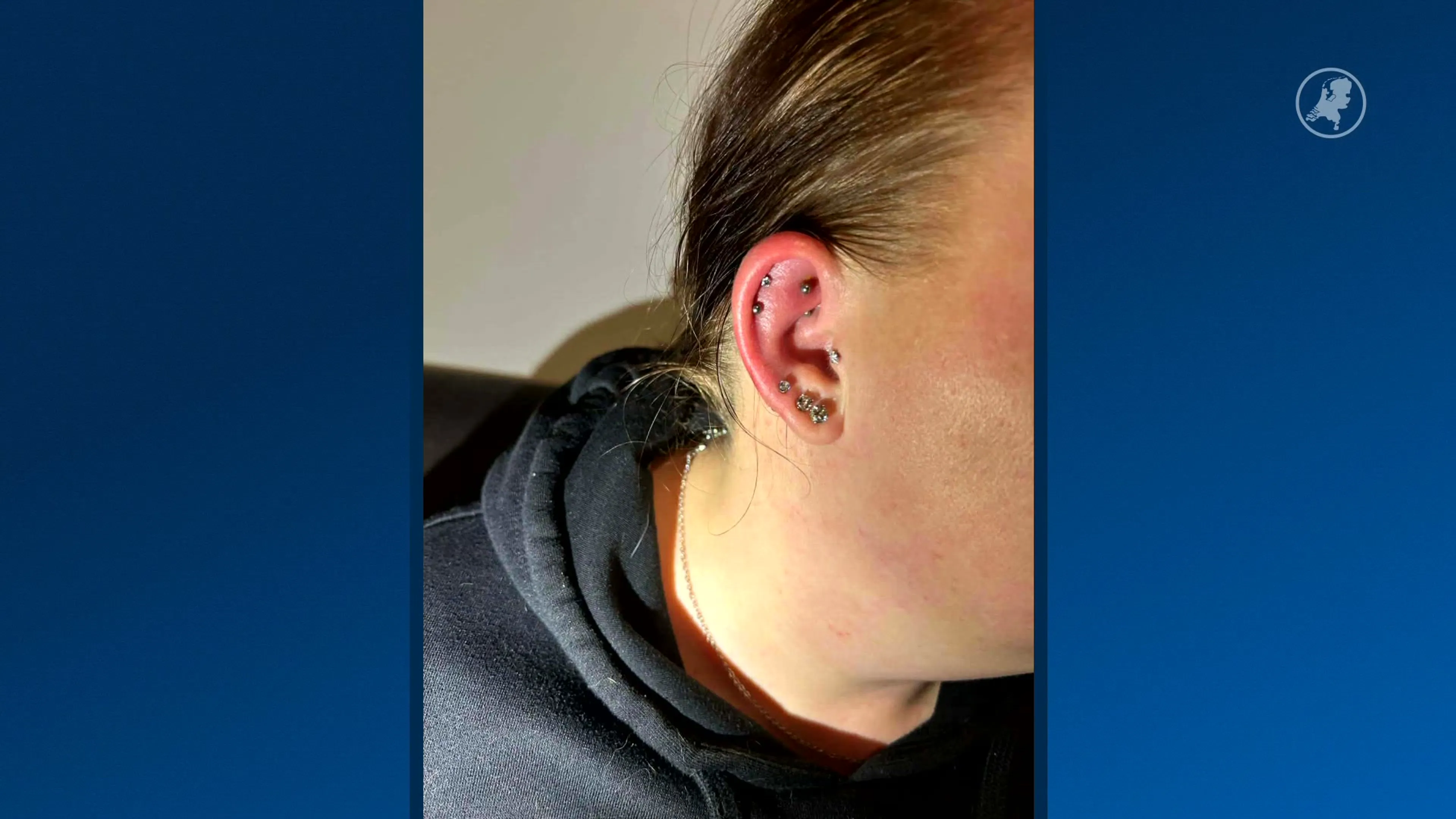 Jolanda werd ziek na gebruik nazorgspray voor piercings