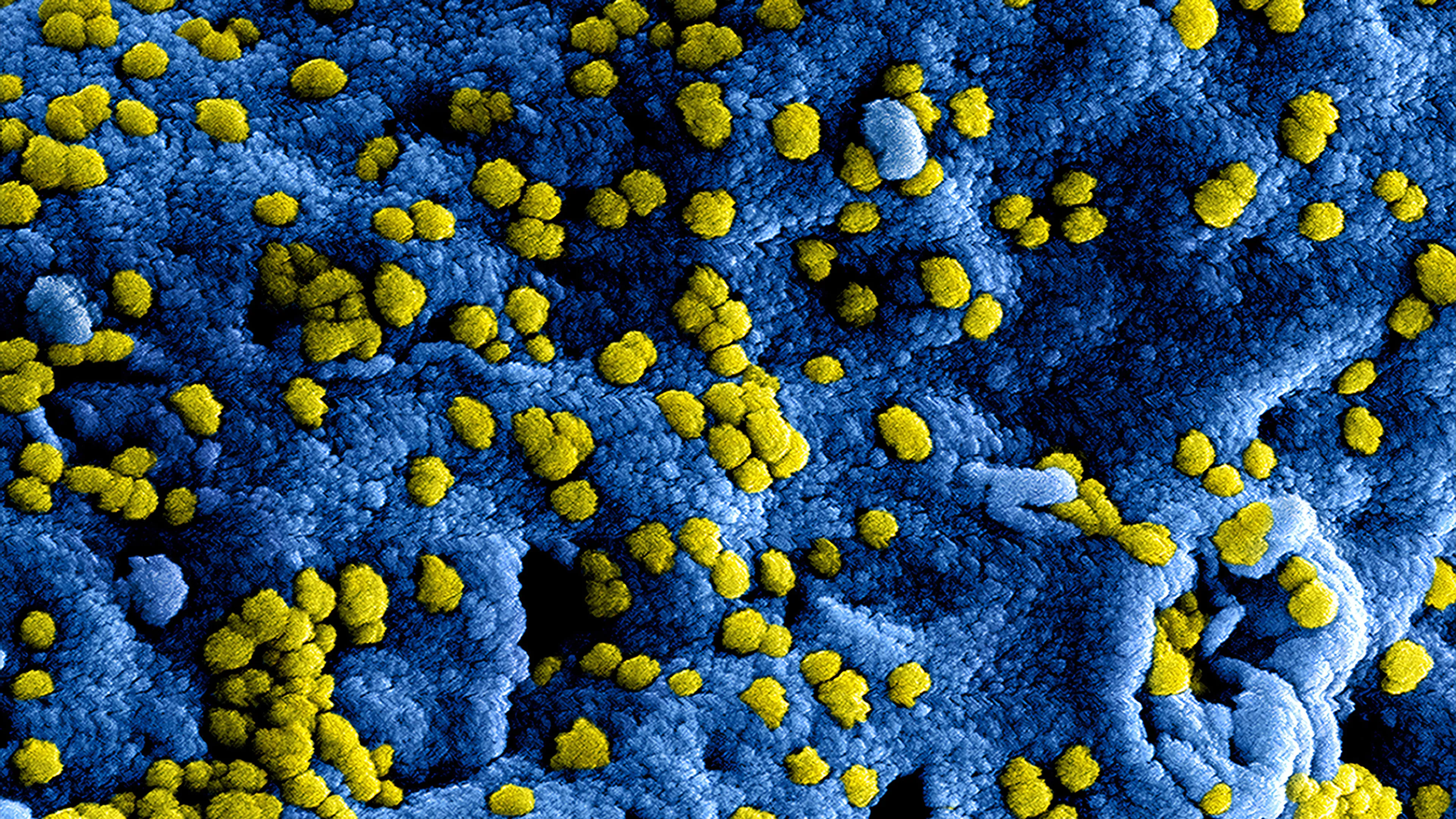 Eerste Nederlander overleden aan gevolgen coronavirus