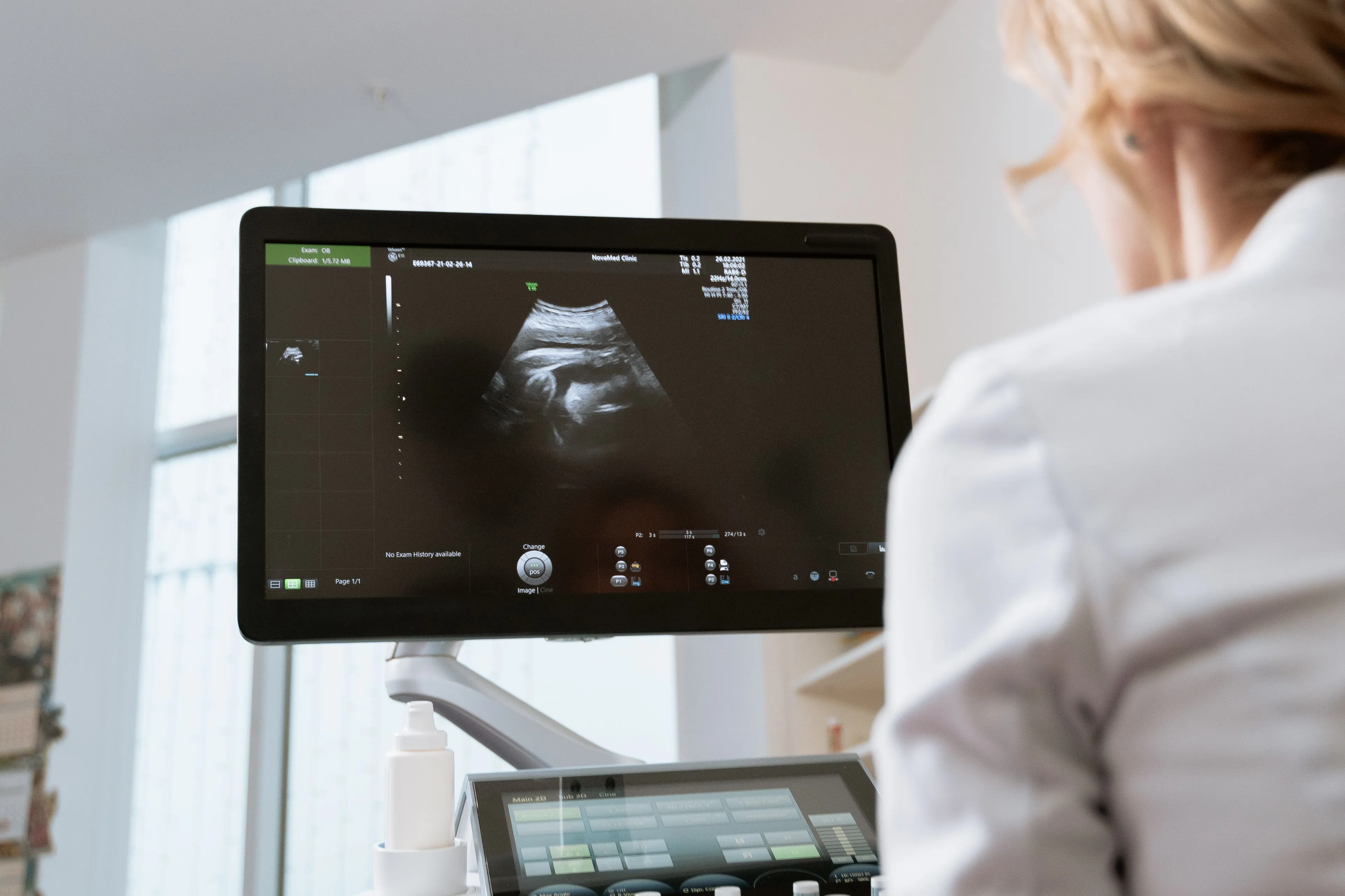 Geen 13 wekenecho meer voor zwangere vrouwen na 2027