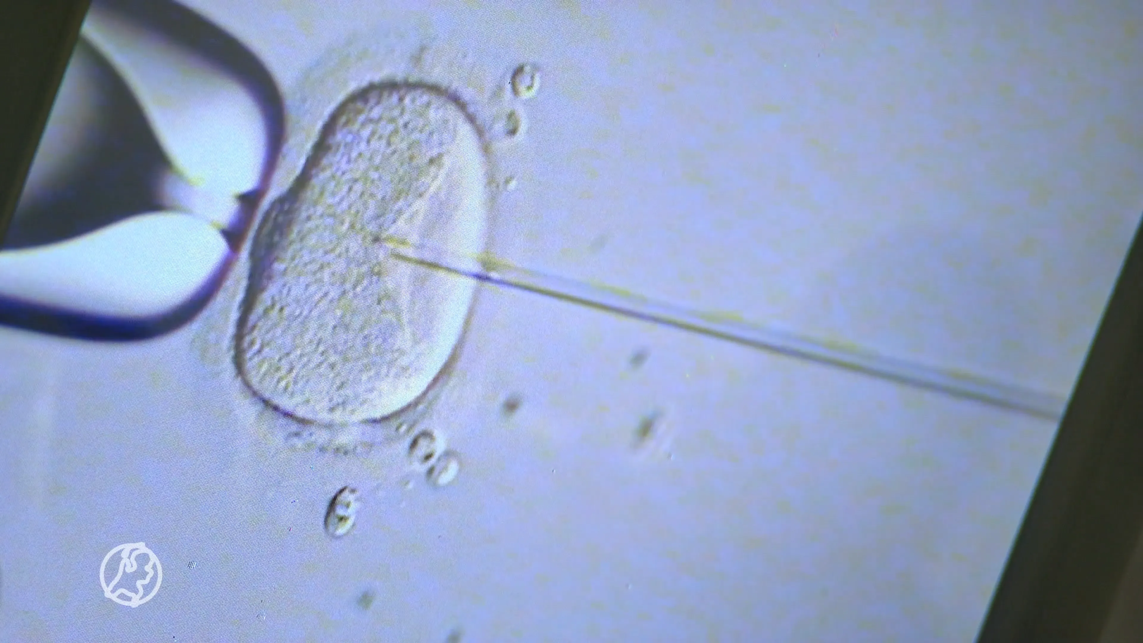 Al vier decennia ivf in Nederland: 'Niet voor iedereen vanzelfsprekend'
