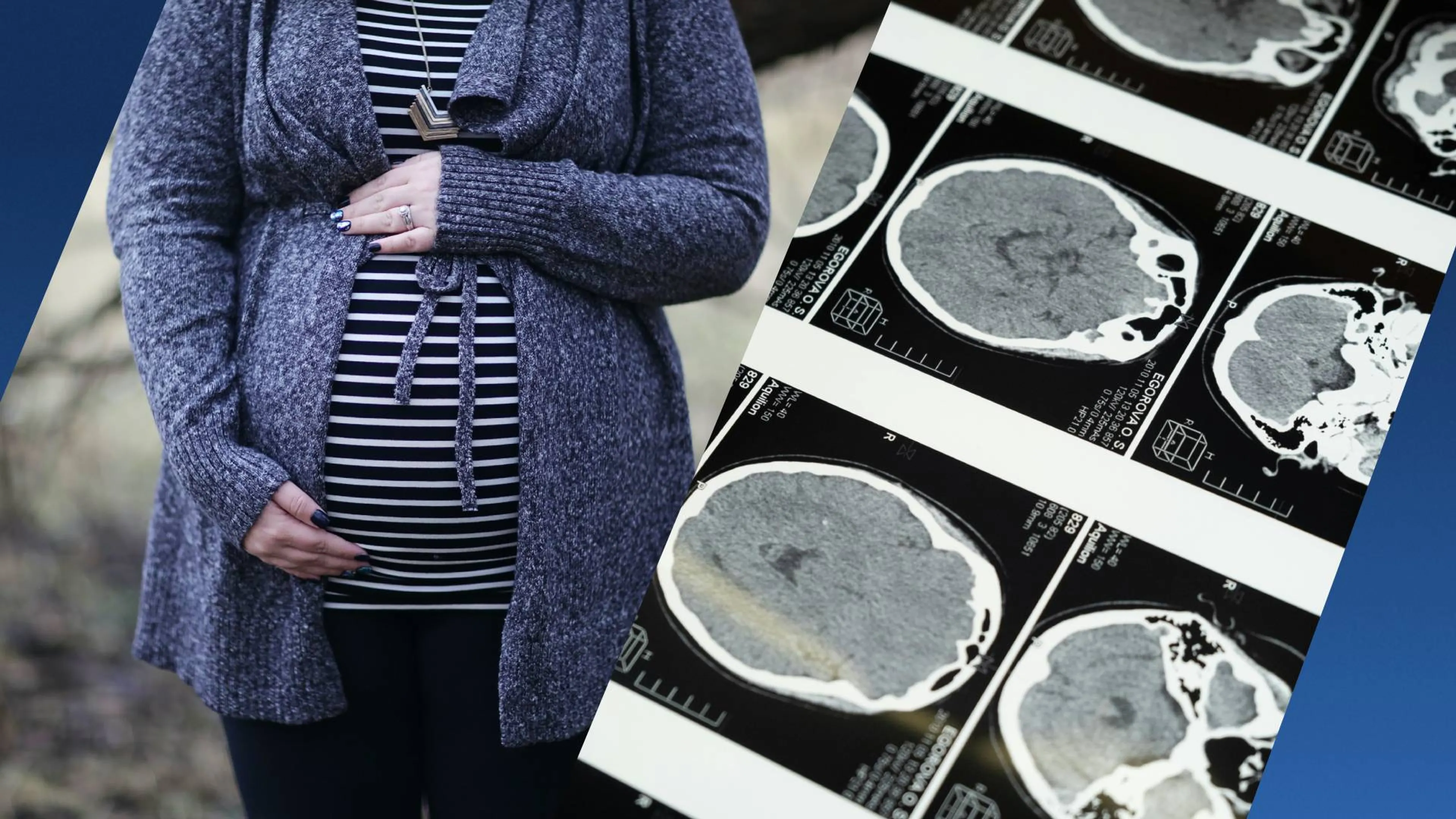 Onderzoek toont aan dat het brein van vrouwen veranderd door zwangerschap