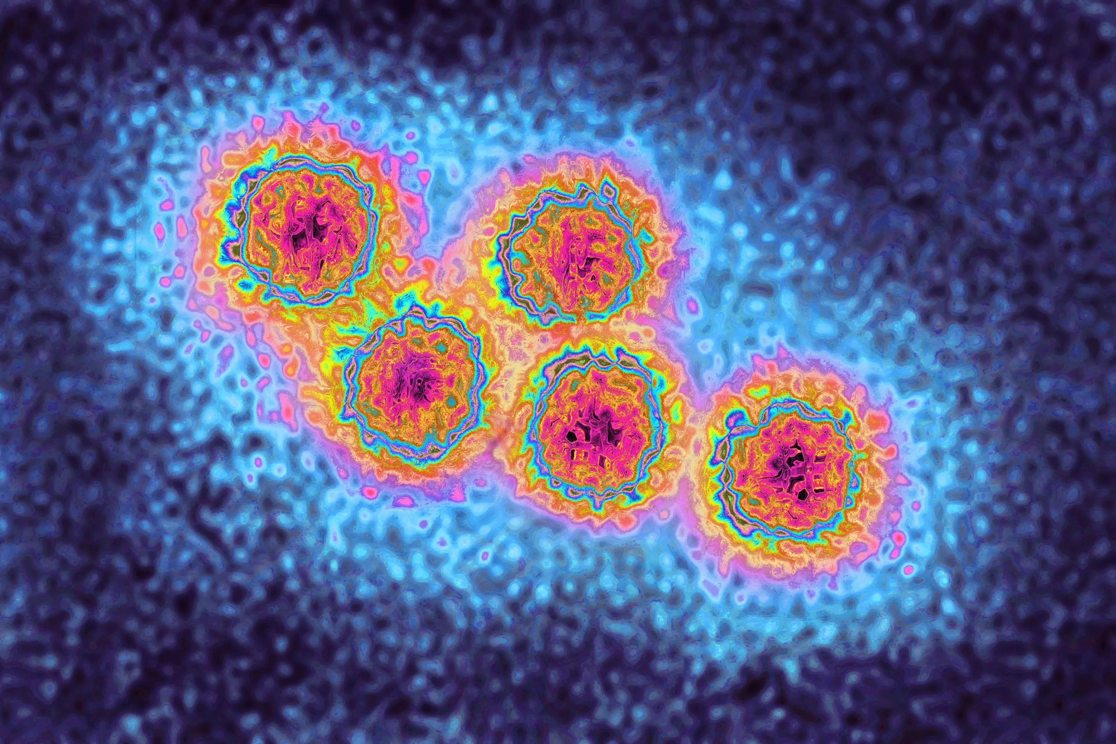Eén kind overleden aan acute hepatitis; vier Nederlandse kinderen hebben deze gevaarlijke ziekte