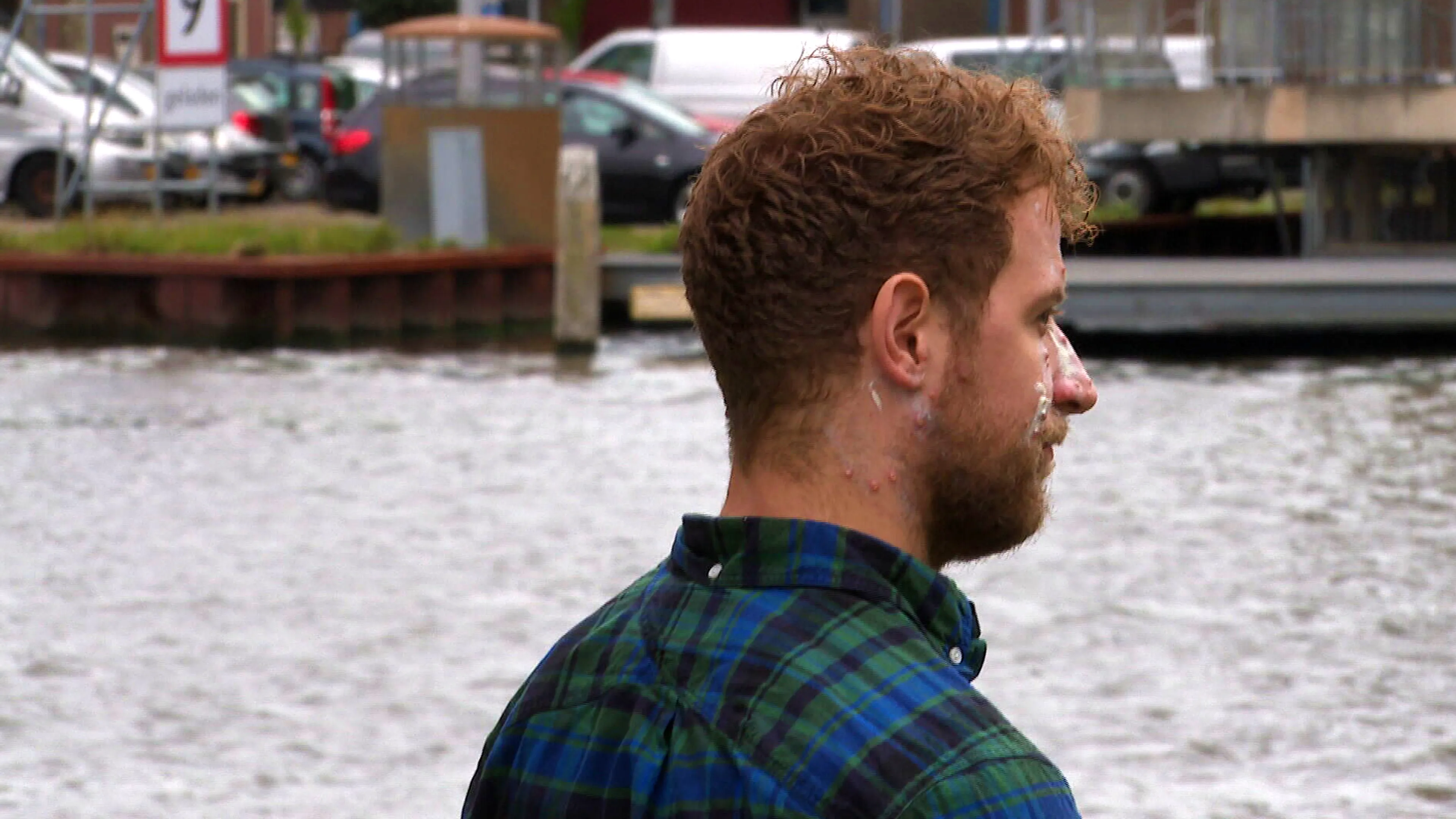 Nick kreeg de apenpokken: 'Je hoeft je er niet voor te schamen'