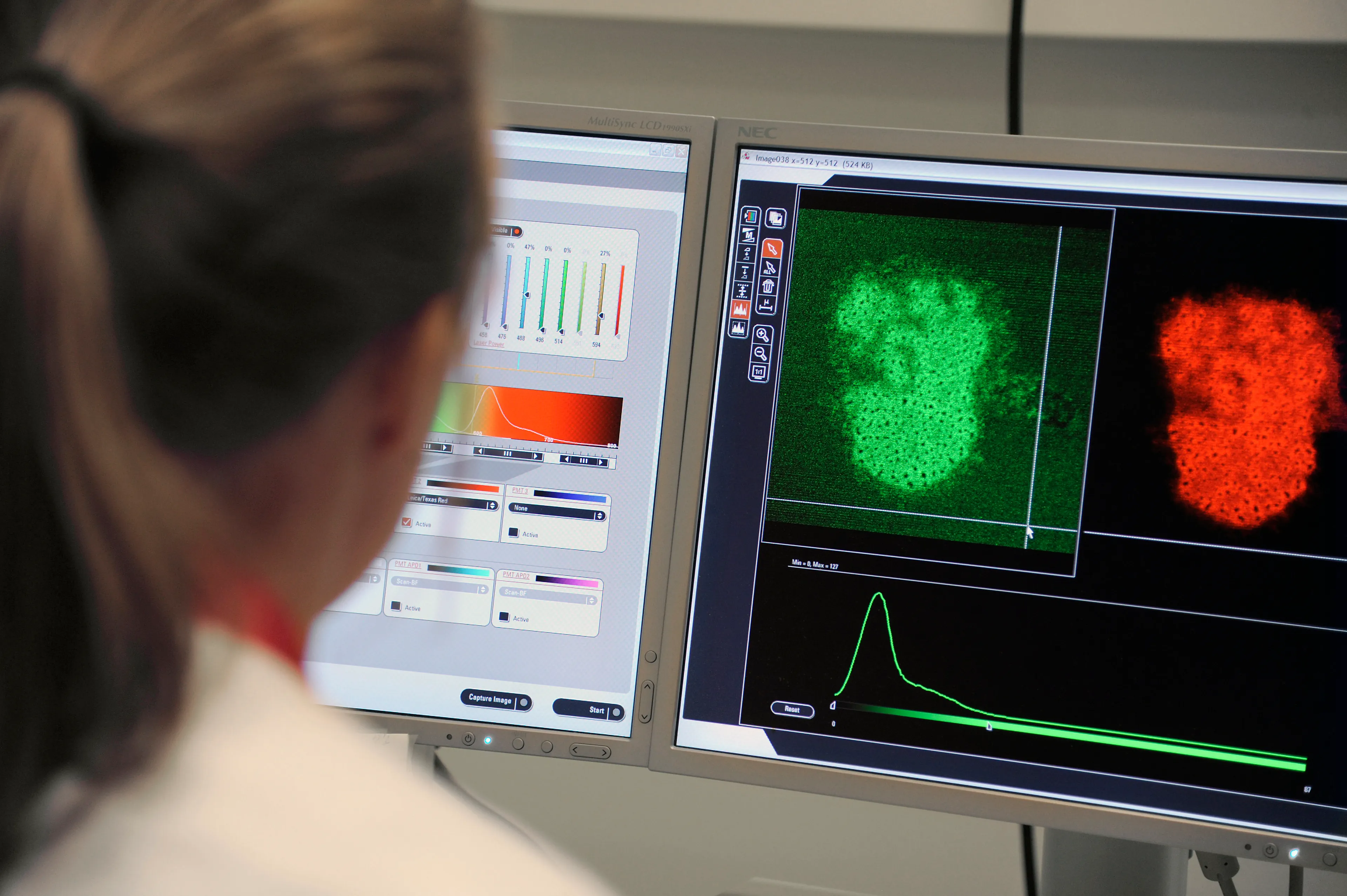 Een op drie patiënten met zeldzame kanker krijgt eerst onjuiste diagnose