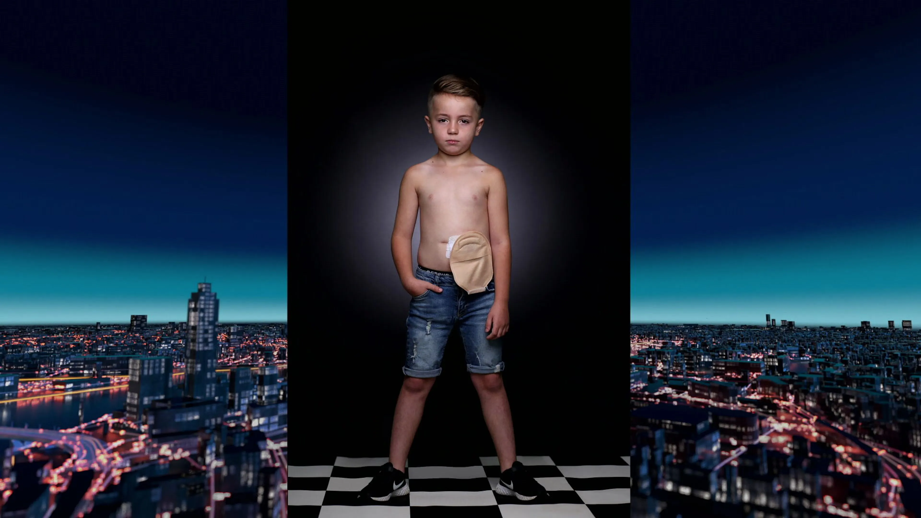 Narik (7) heeft een stoma en schaamt zich er niet langer voor