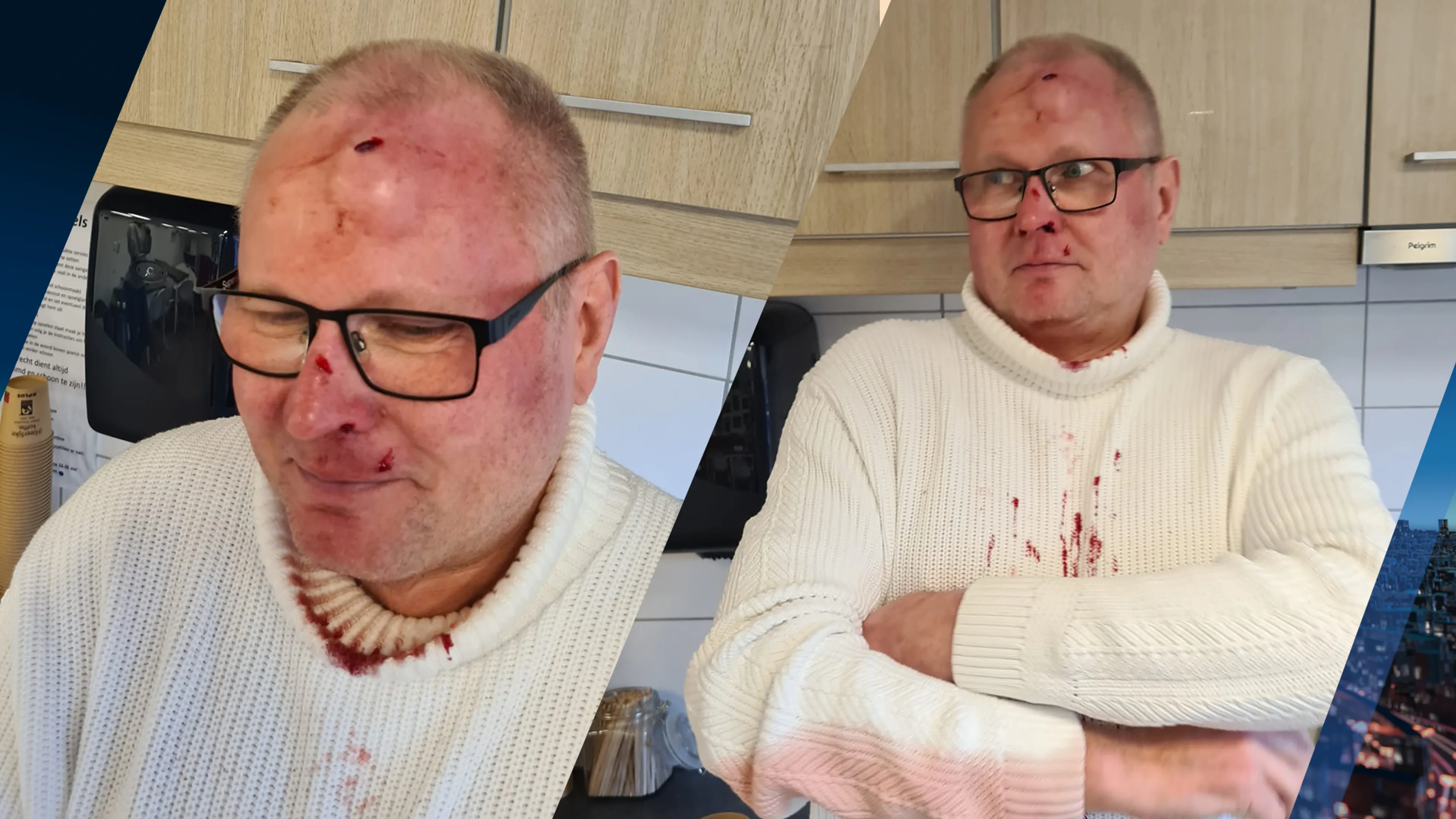 Alwi (59) wilde pak koffie halen, maar werd zwaar toegetakeld