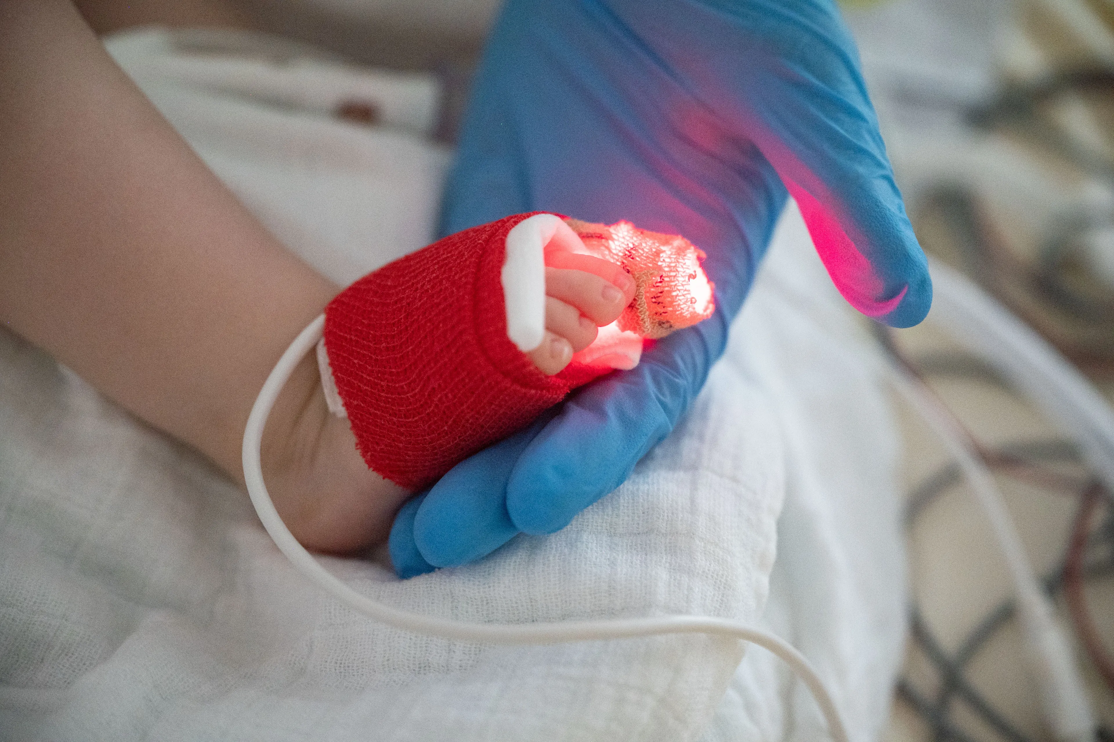 Grote drukte op kinder-ic's door griep en RS-virus, 'maar nog geen reden tot paniek'