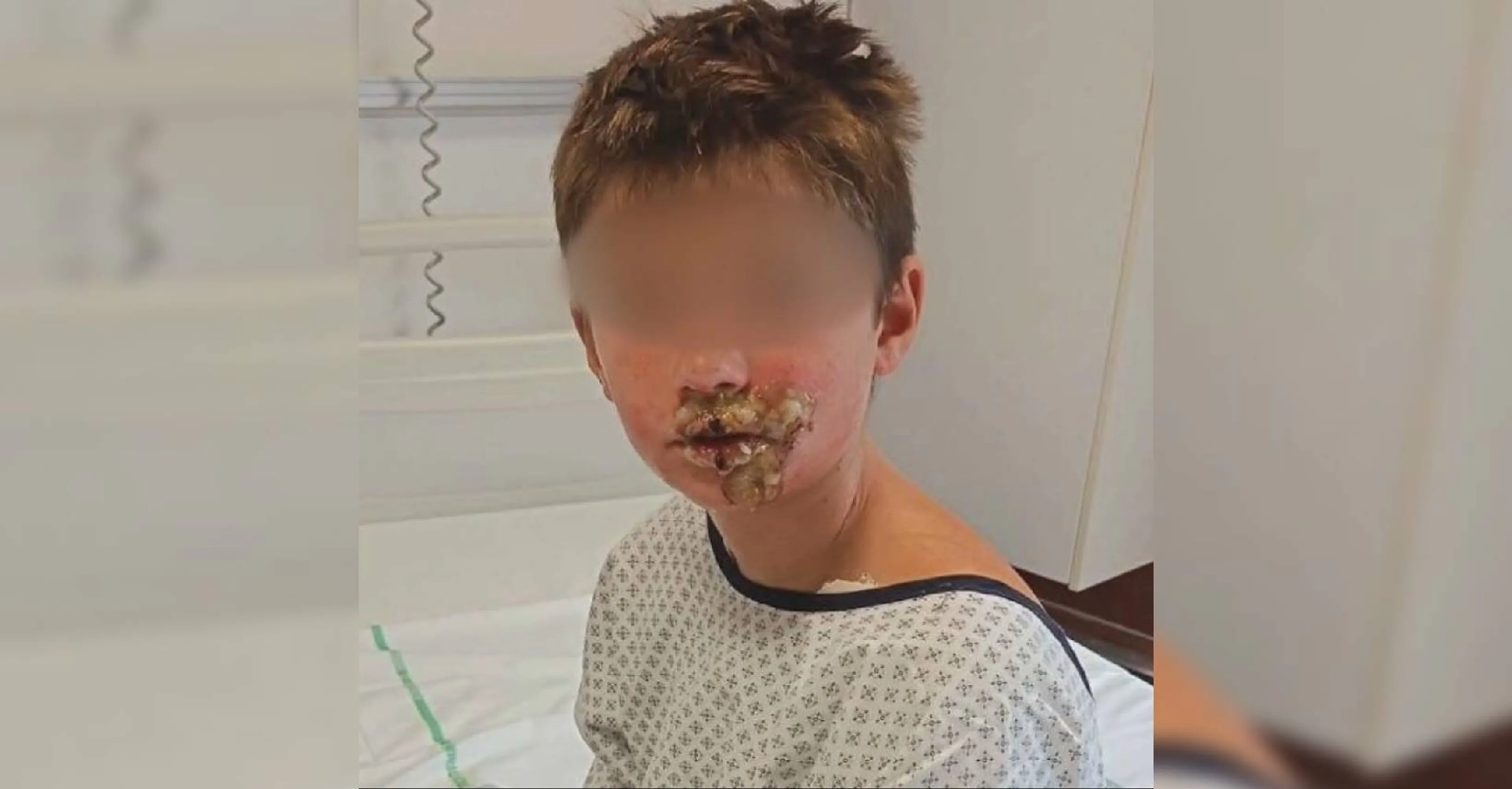 Onderzoek naar squishy die ontplofte in gezicht 8-jarige jongen
