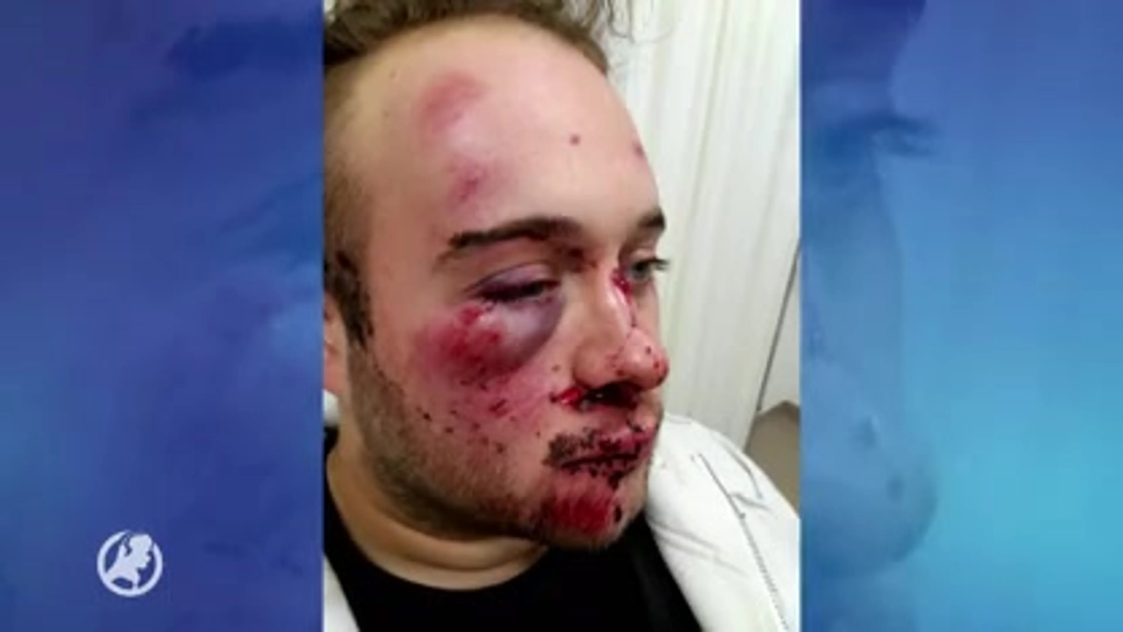 Politie duikt alsnog in mysterie rond toegetakelde Brian