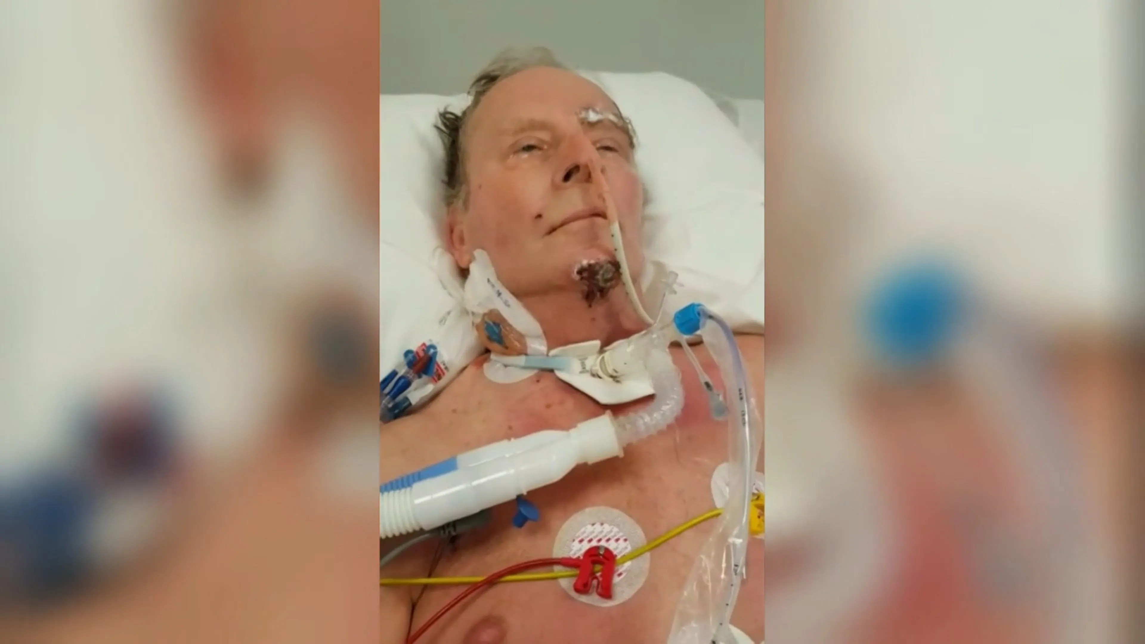 Frans (60) ontwaakte uit zijn coma van coronavirus: 'Ik heb z...